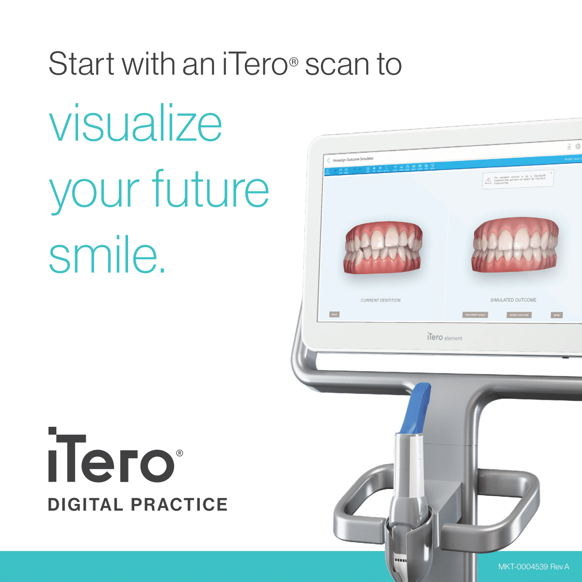 iTero™ Digital Impressions - New Hyde Park — Nexus Orthodontics ...