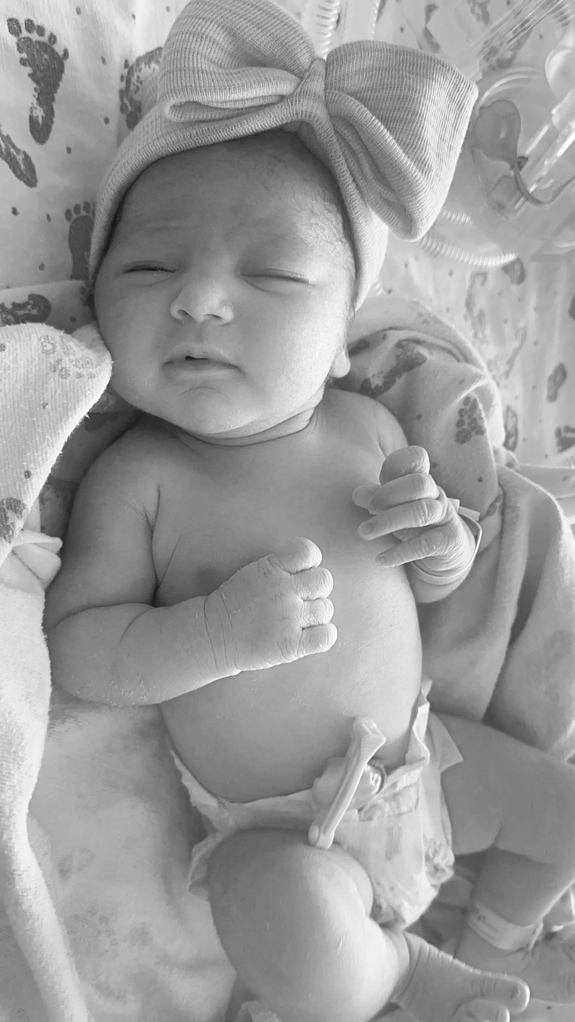 Rancho Springs vs. Loma Linda Murrieta: Which Hospital Is Right for Your Birth?