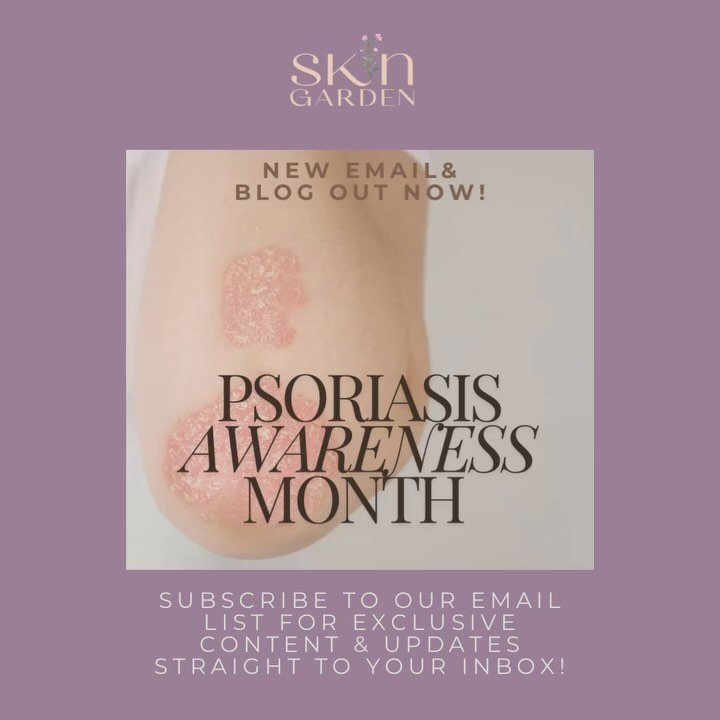 August is 𝐏𝐬𝐨𝐫𝐢𝐚𝐬𝐢𝐬 𝐀𝐰𝐚𝐫𝐞𝐧𝐞𝐬𝐬 𝐌𝐨𝐧𝐭𝐡 🩺

new on the blog: Join us in chatting all about how you can help to manage and soothe Psoriasis and also busting the myth that you can&rsquo;t get a facial with facial psoriasis because yo