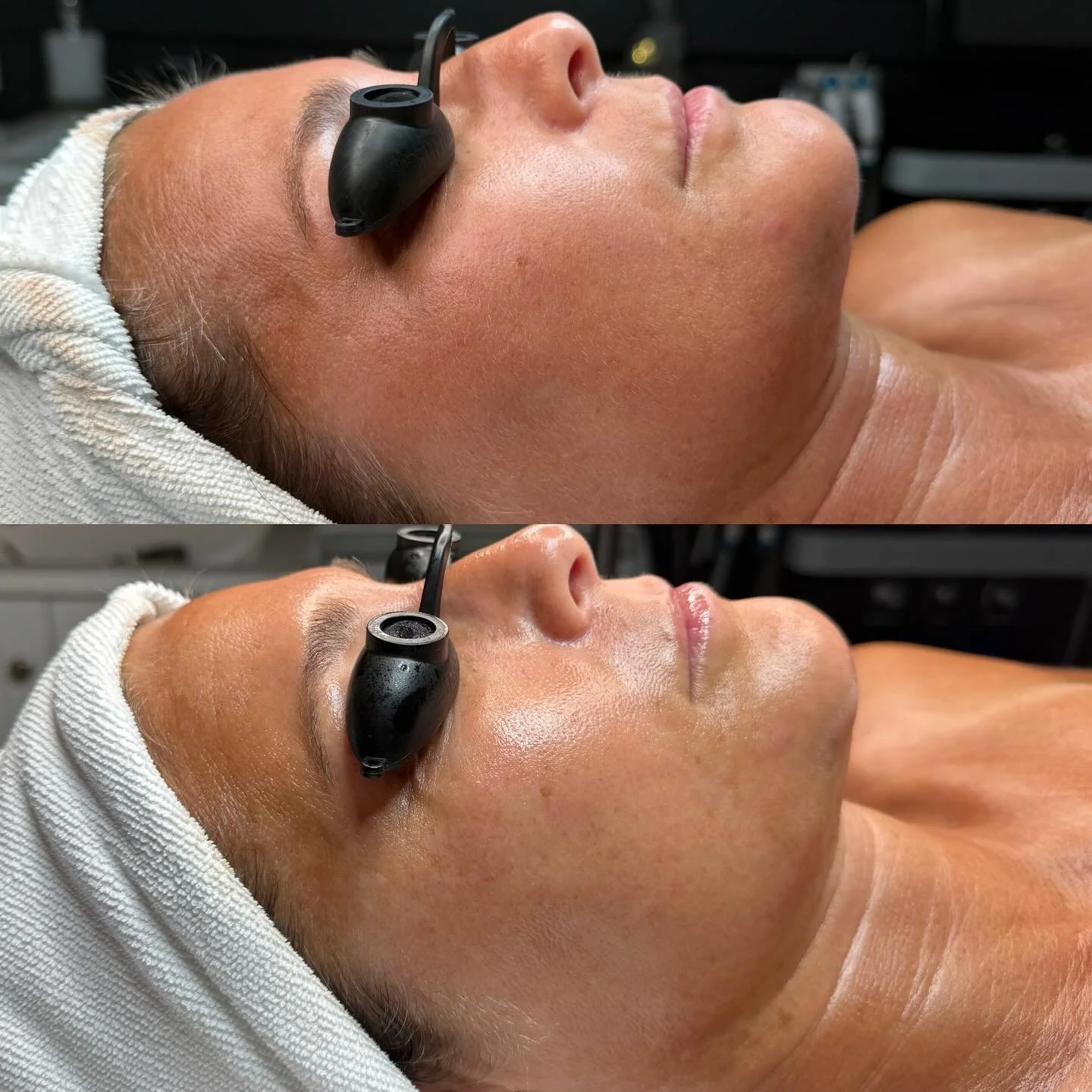 Skin looking a little&hellip; parched? 🌵
Too much sun, not enough barrier love? It happens.

Let&rsquo;s hit reset and bring your glow back to life with deep hydration, skin-calming nutrients, and the kind of facial that makes your skin say thank yo