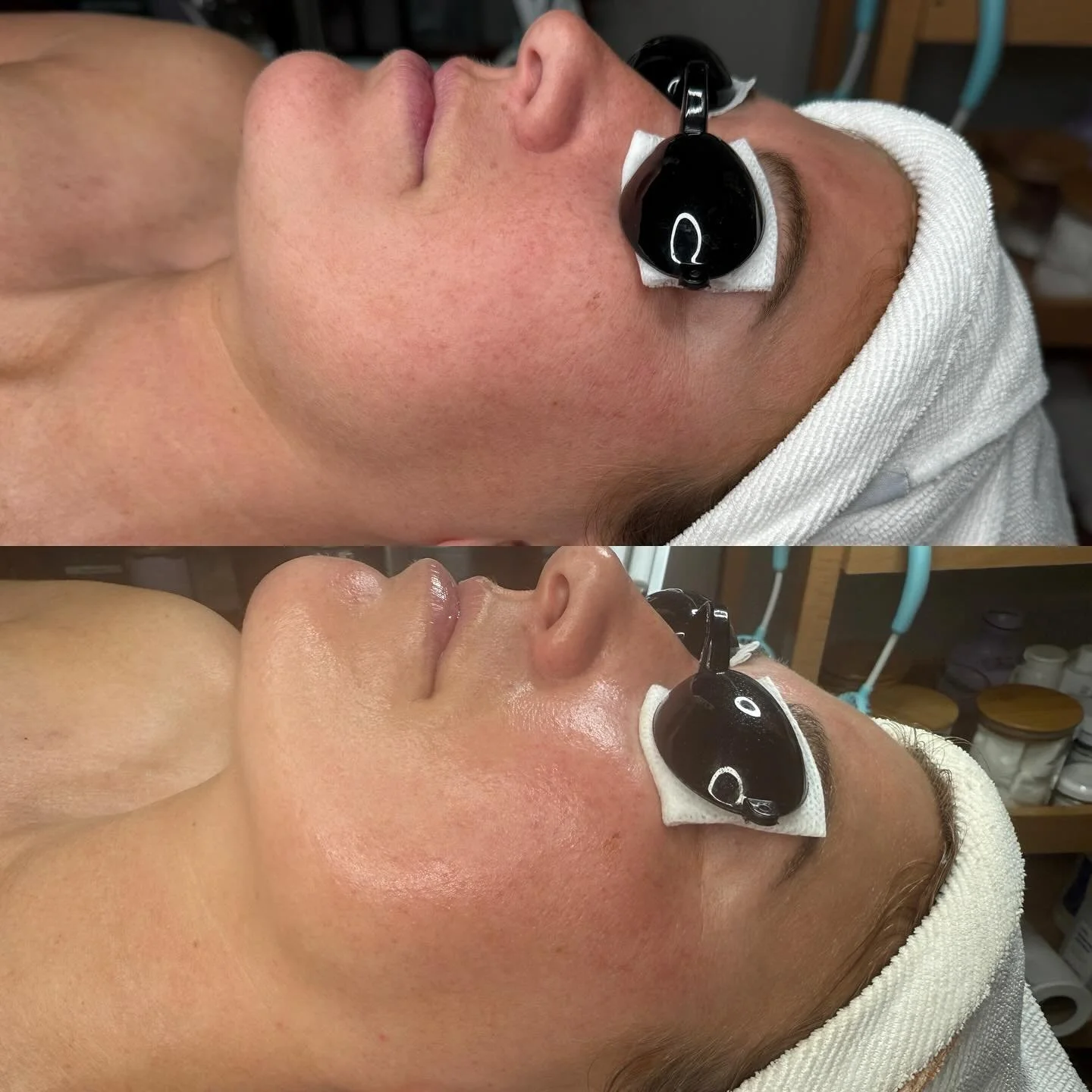 First time facials are some of my absolute favorites! There&rsquo;s just something so exciting when giving someone their first facial ever. I love to spoil all my clients, but especially someone&rsquo;s first time. 🤩 
Have you ever had a facial? Com