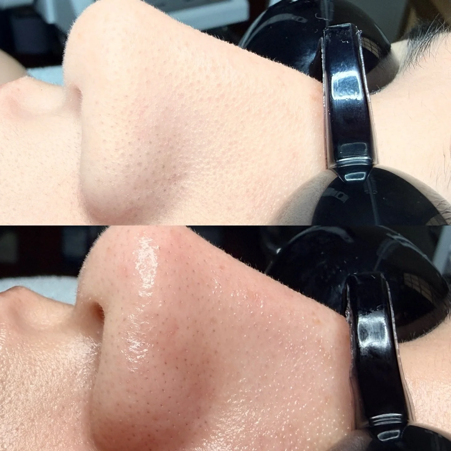 One. Single. Facial. To address texture and dullness&hellip; 💅 Not to toot my own horn or anything but, toot, toooooot! 🤣🤣🤣

If you&rsquo;re serious about improving your skin now, book your facial treatment online. What are you waiting for? 
Book