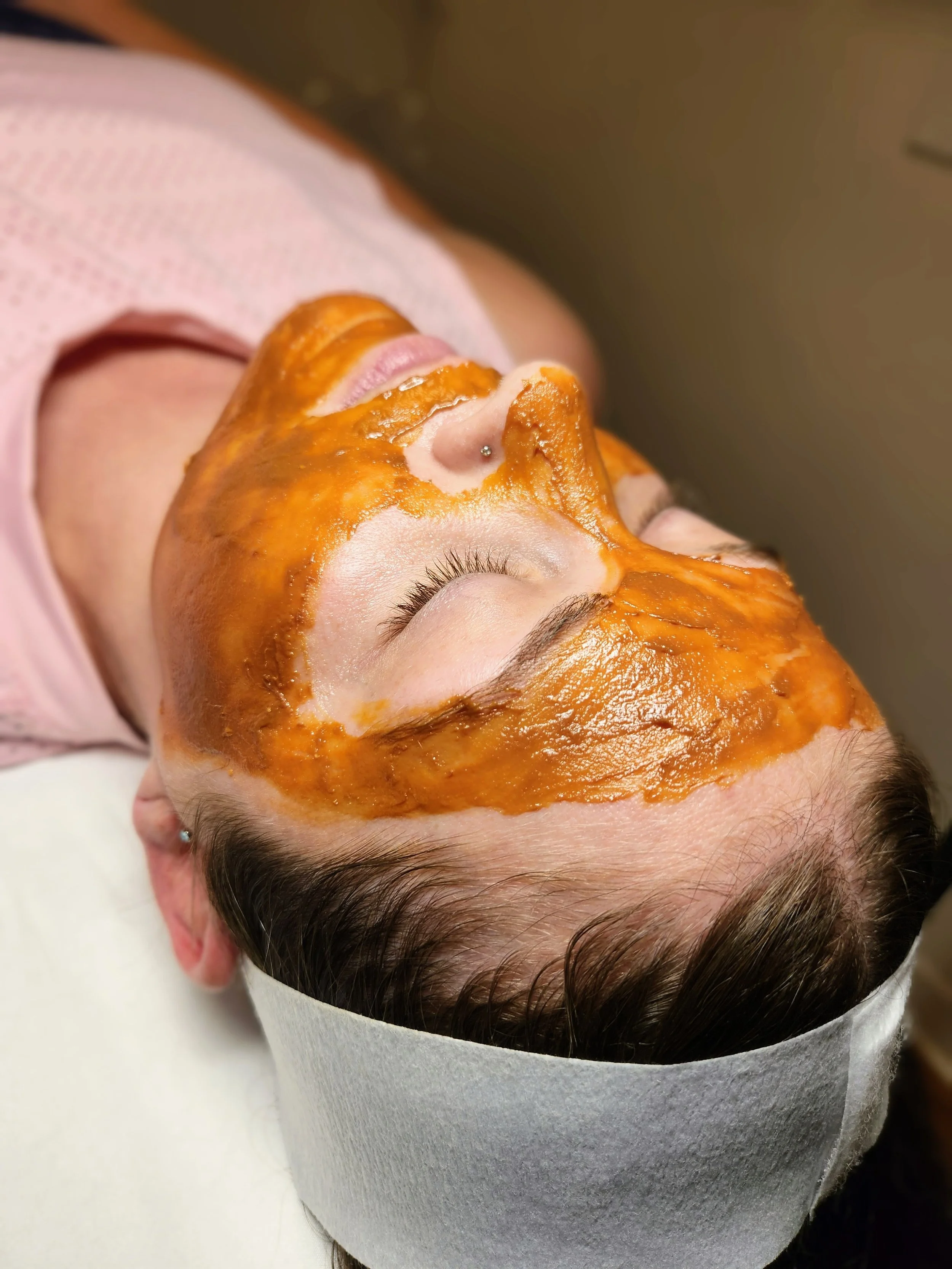 How Often Should You Get a Chemical Peel for Maximum Results?