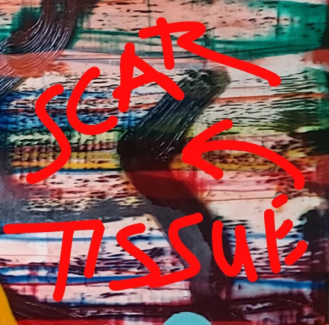 John Cronin Scar tissue image detail.jpeg