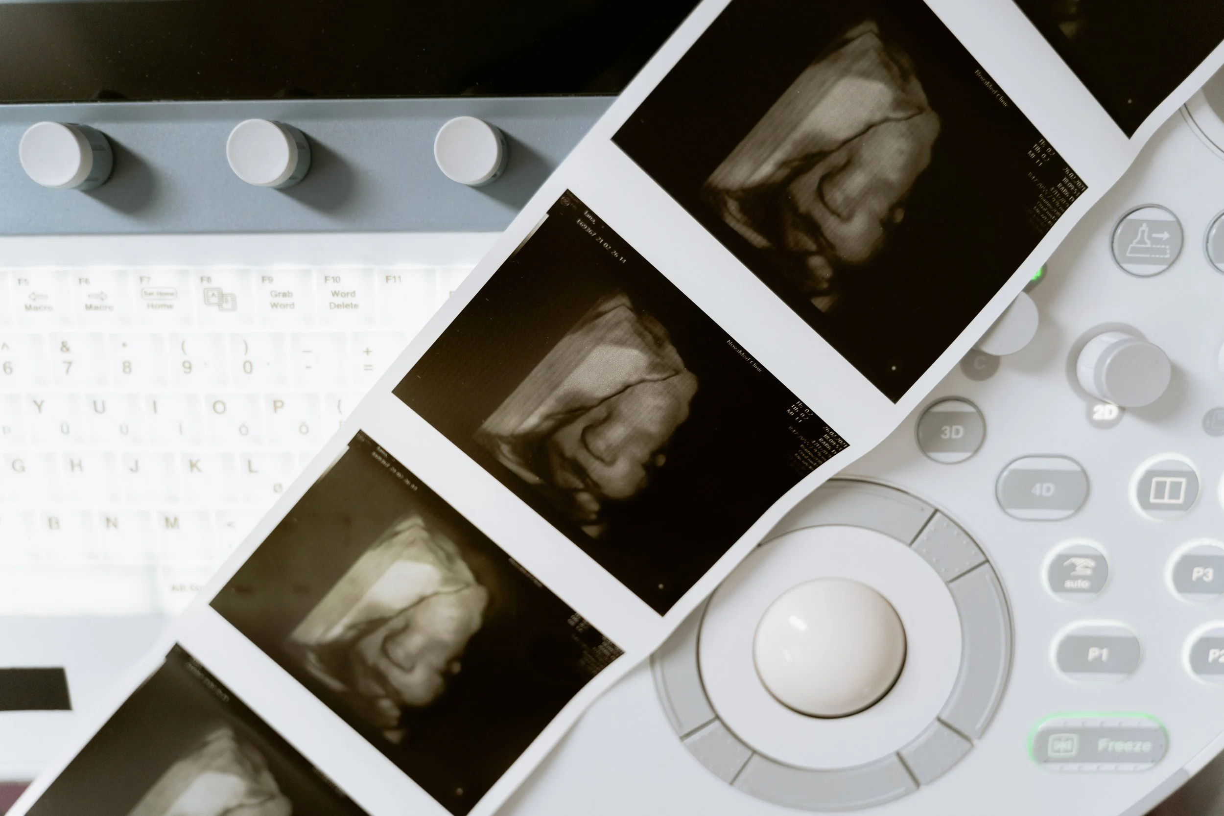 For Providers | Partner with Excellence — Elite Ultrasound Imaging | 3D ...