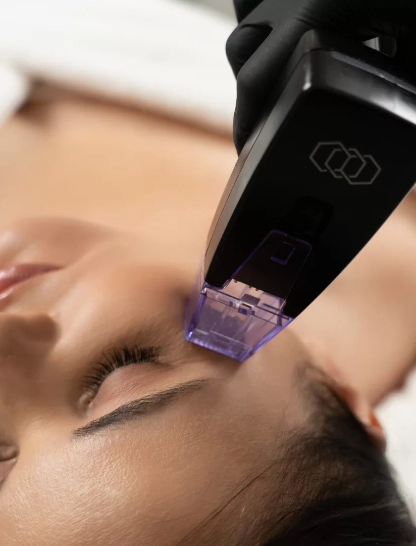 Close-up of a smiling woman with clear skin, freckles, bright eyes, and short brown hair.