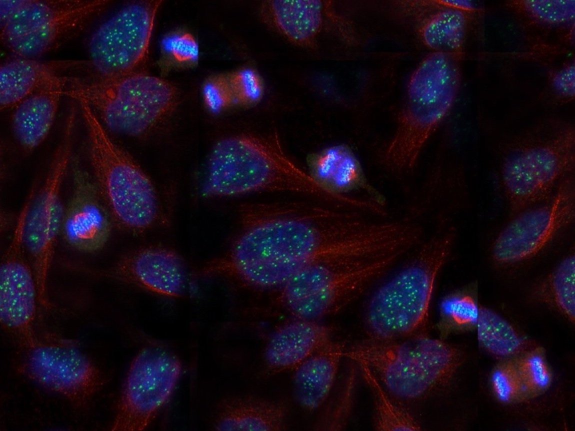 Carrier JS., Torvi JR., et al. Stimulating microtubule growth is not the essential function of the microtubule polymerase Stu2,  bioRxiv. 2022