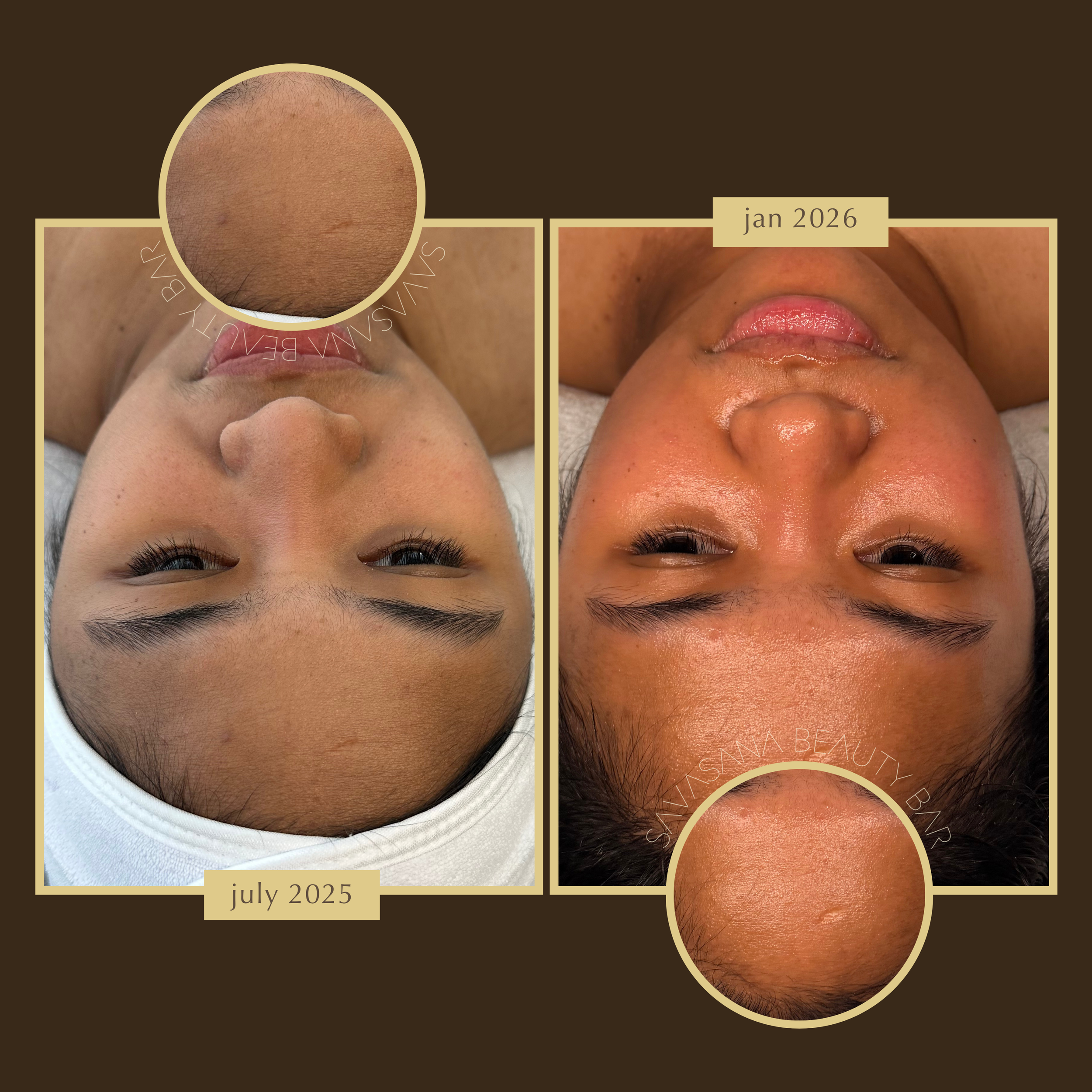 facials