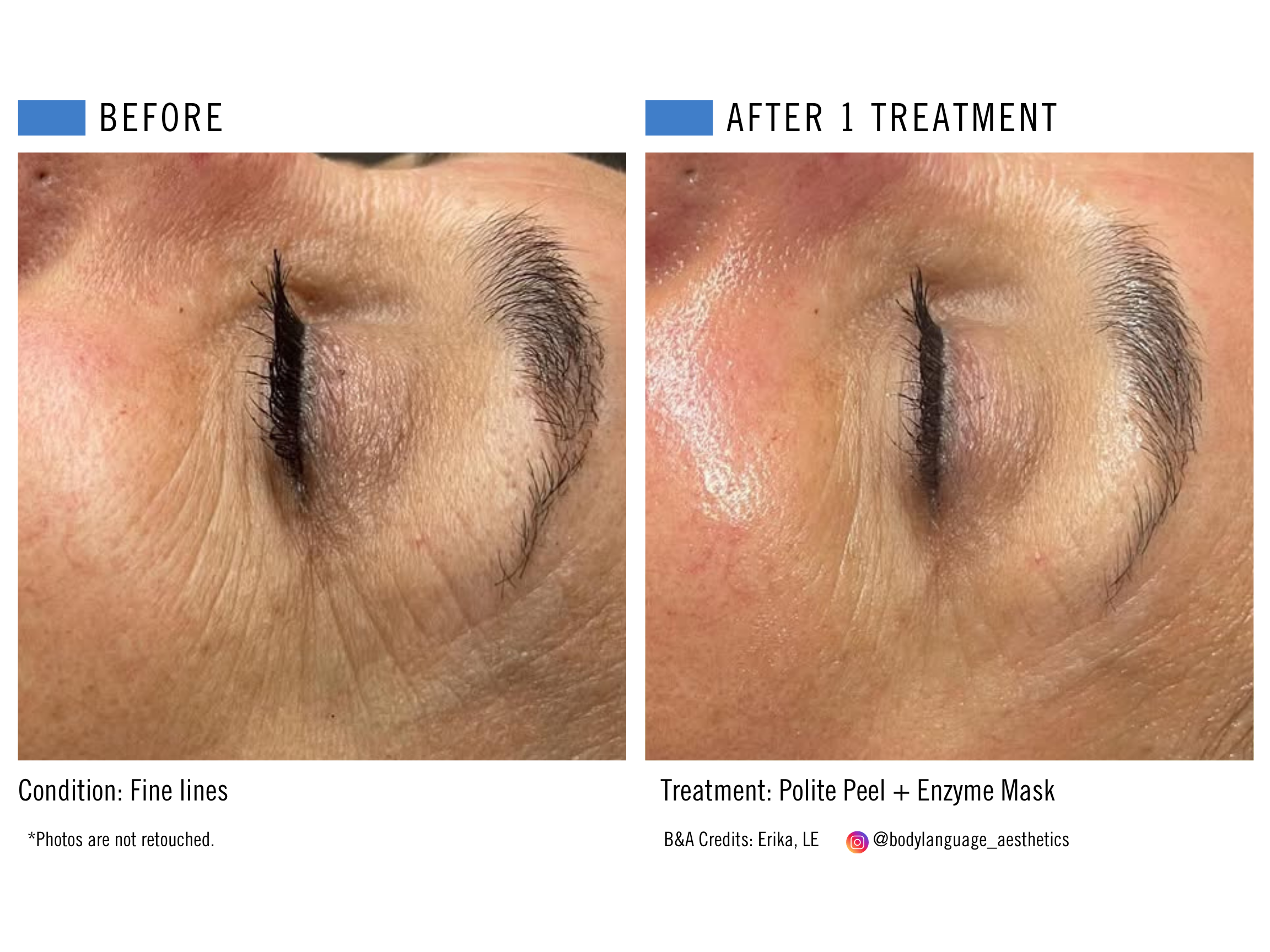 Polite Peel + Enzyme Mask.png