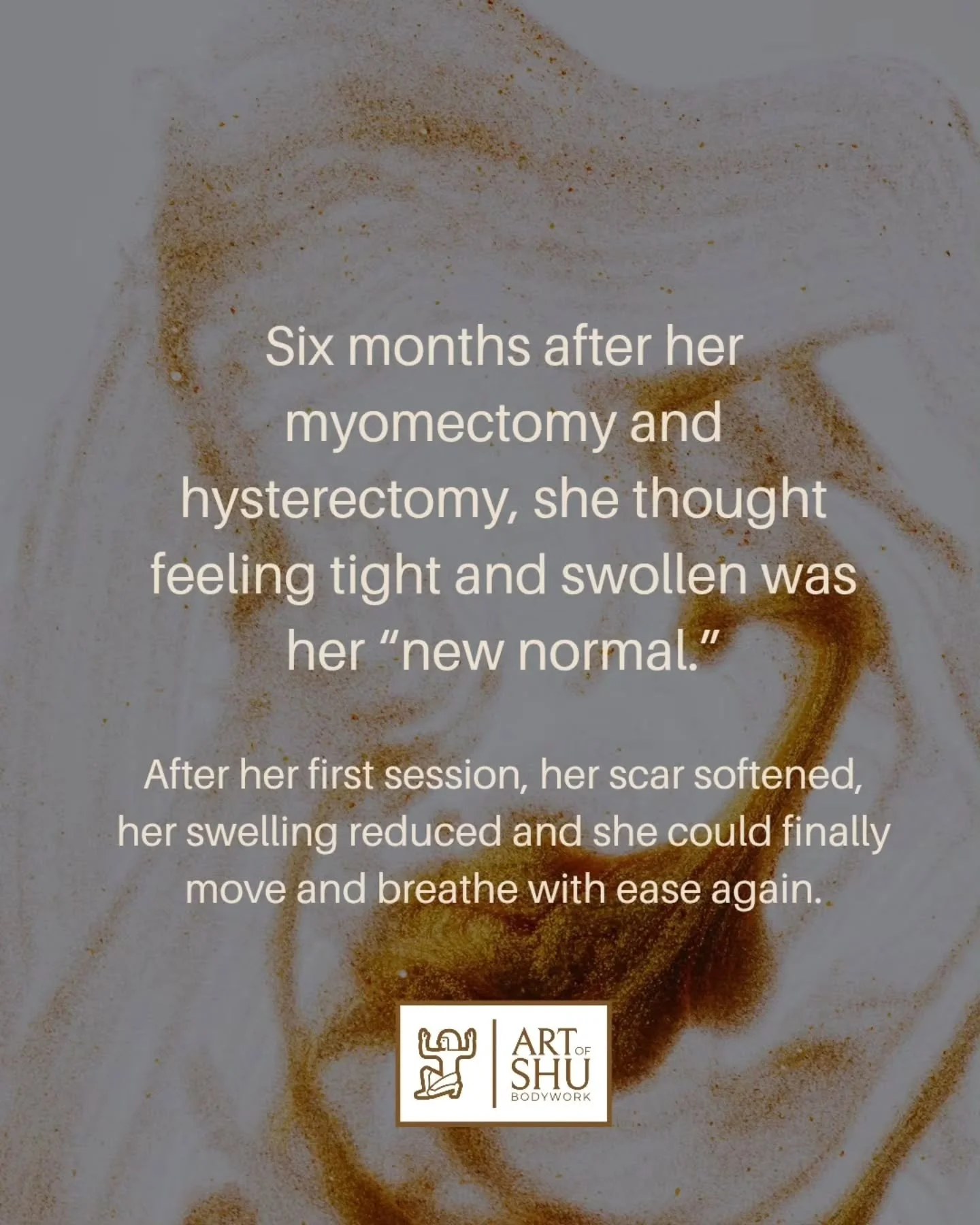 Six months post-op, @allthingsmisstrish thought the tightness and swelling were her new normal until one session changed things.
Her scar softened, her swelling eased and she could finally move and breathe better.

💬 She&rsquo;ll be sharing more of 
