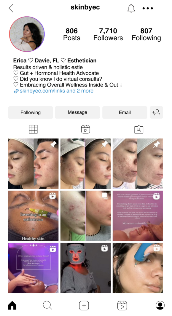 Instagram profile page of Erika, an esthetician from Davie, Florida, showing posts related to skincare treatments and facial care.