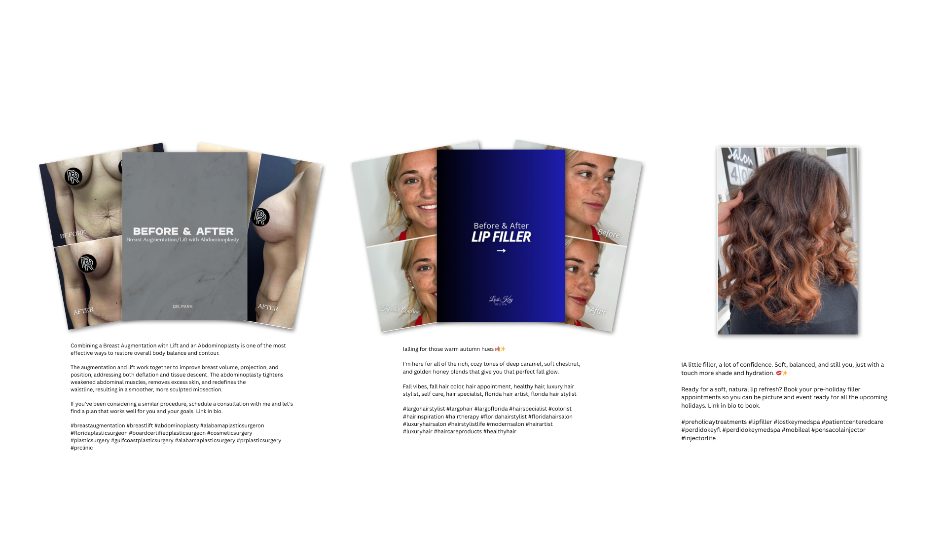 Example social media post showcasing a collage of three different beauty treatments: breast augmentation by Dr. Christopher Park, lip filler by Lost Key Med Spa, and hair styling by Girl Talk Hair. Each section includes before and after photos, along with descriptive text about each procedure.