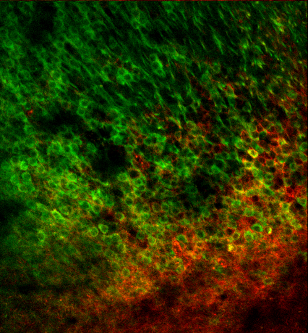 GCaMP6f Transgenic Mice (Green) with CaMKII-ChRmine (Red)