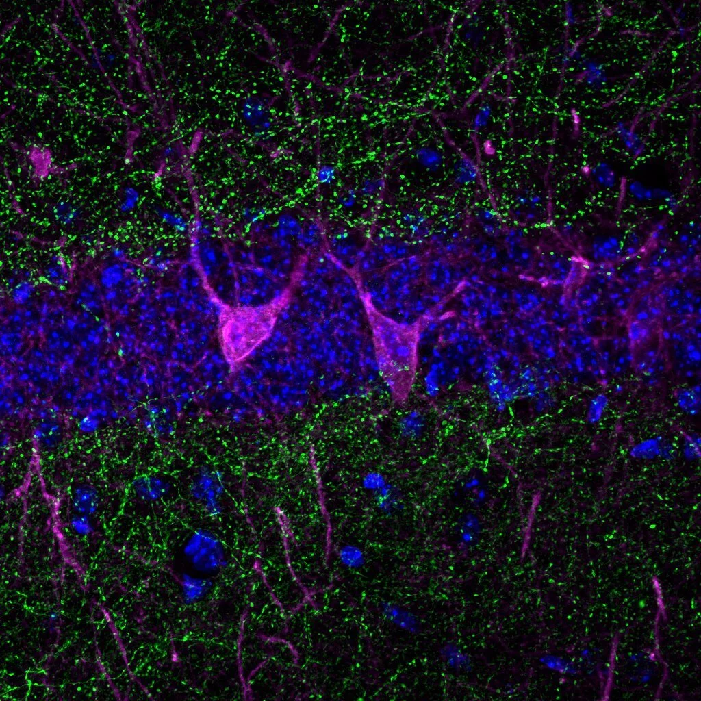 Parvalbumin interneurons (magenta) in the CA1 with Schaffer collateral axons (green) from the CA3. Cell nuclei labelled with DAPI (blue)