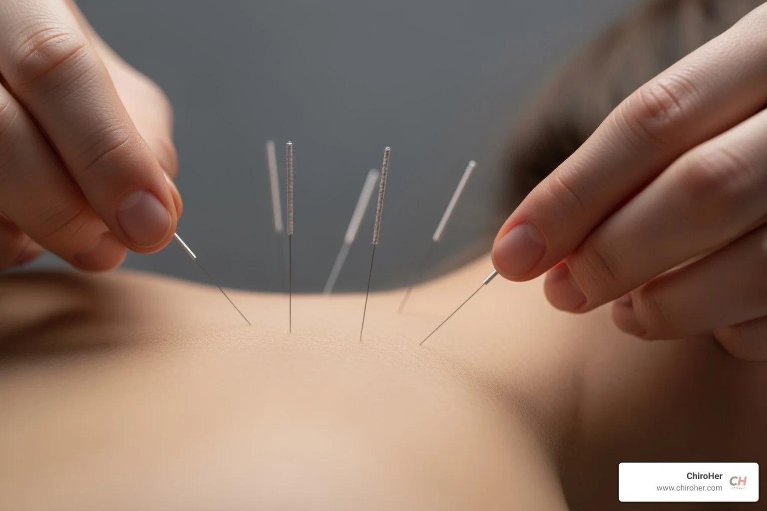 Beyond the Buzz: Unpacking Acupuncture's Role in Pain Relief