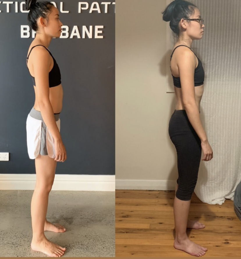 Melissa lateral view.png