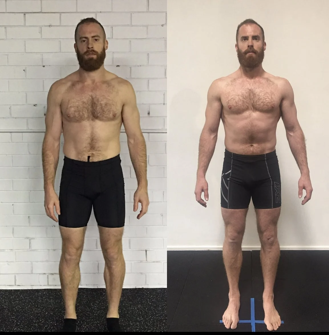 Paul T anterior view.jpg