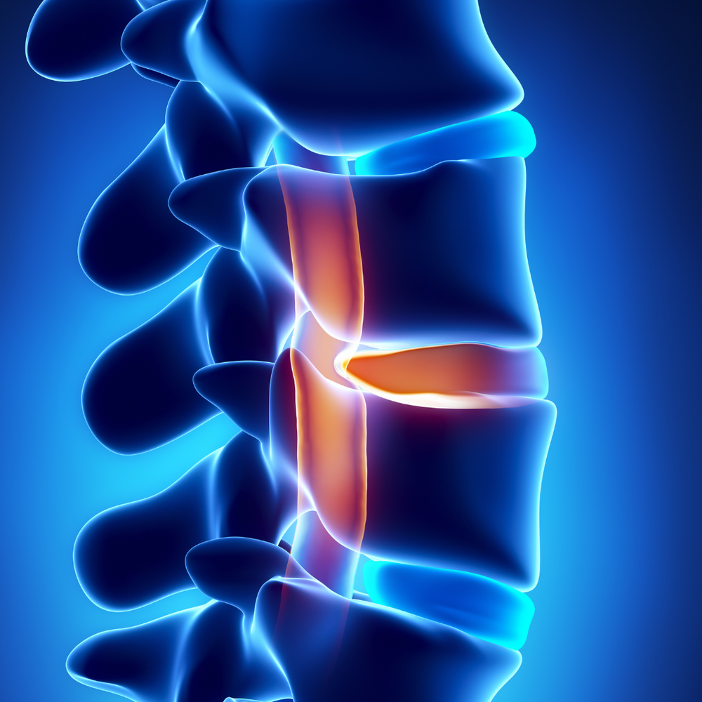 Decompression Therapy