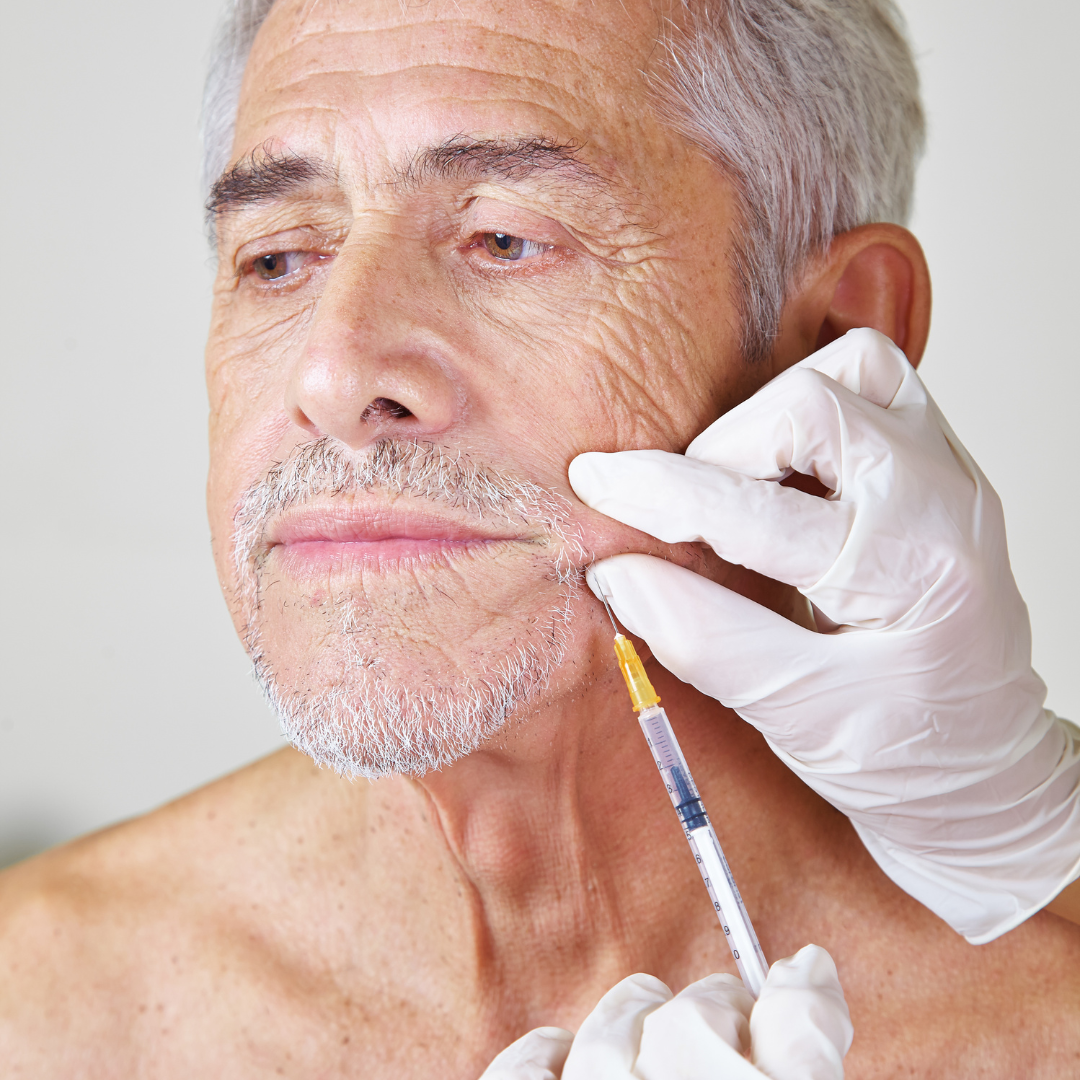 Man in his 50s with visible signs of aging receiving Botox injections around the mouth