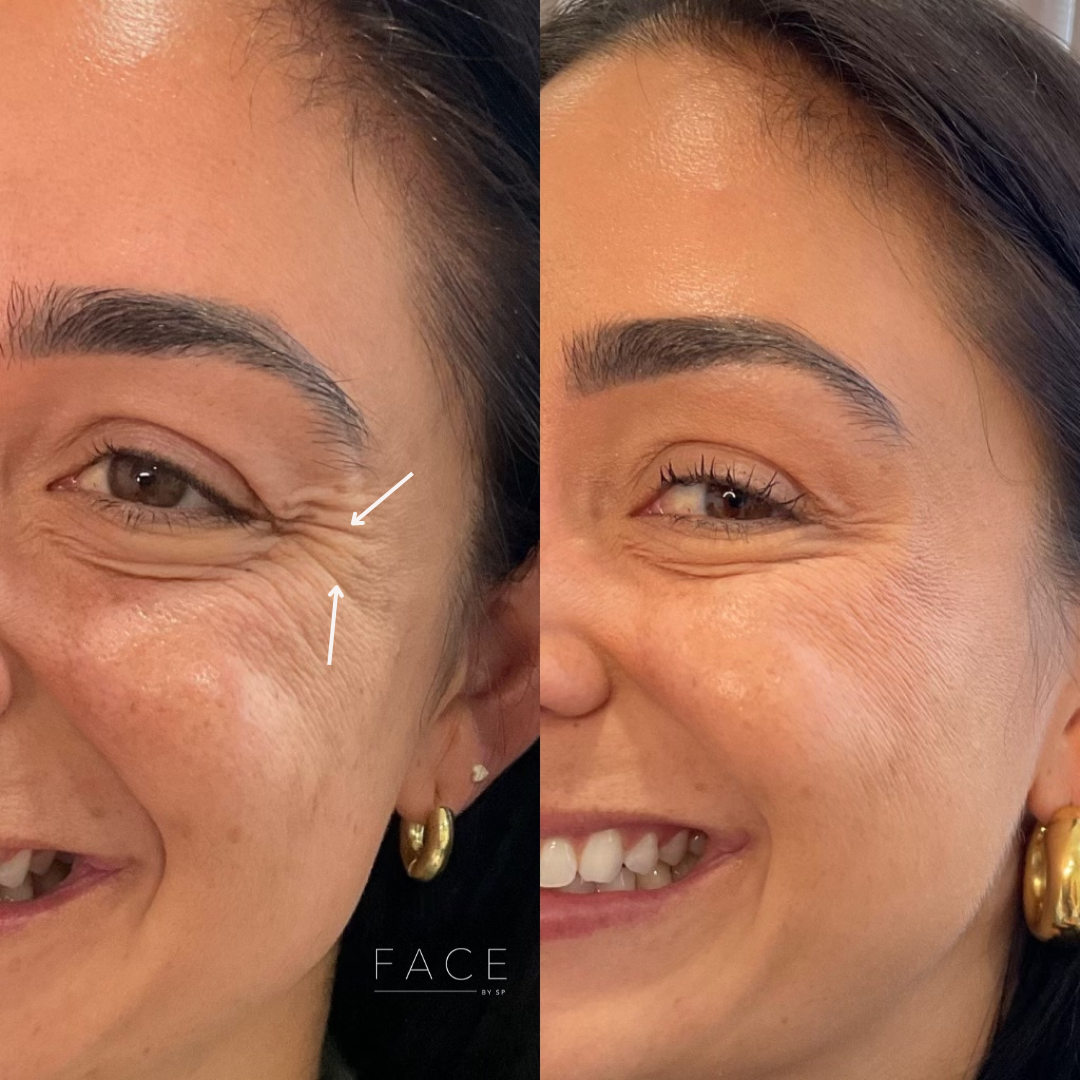 MORE B&A (3).png