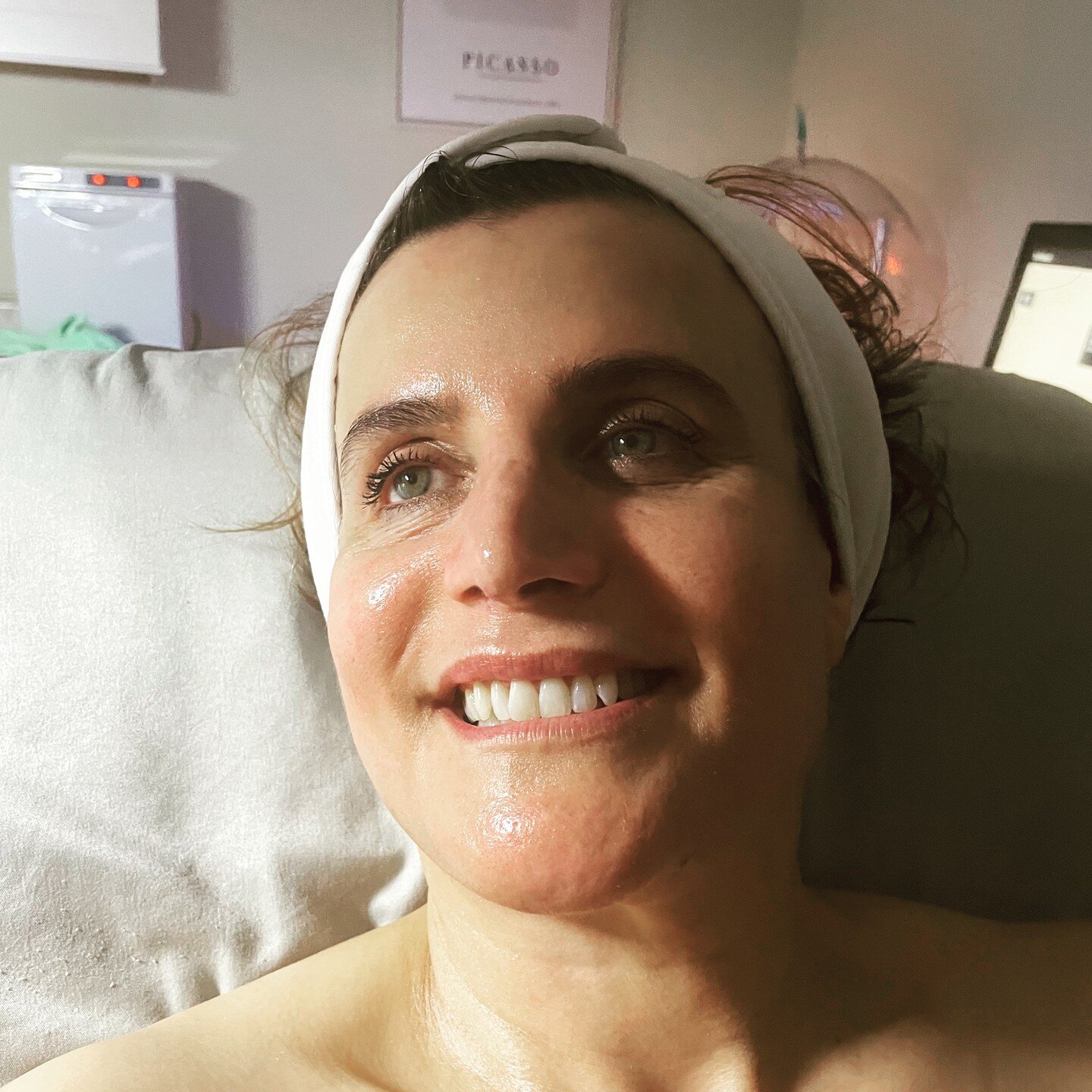 This 57-year young beauty is radiant and lifted after a weekly series of microcurrent and regular Hydrafacials! No Botox or fillers! A woman's dream!
#Oakland,#Oaklandfacials, #hydrafacial,#microcurrent,#oaklandbeauty,#Eastbayskincare,#Valentinesfaci