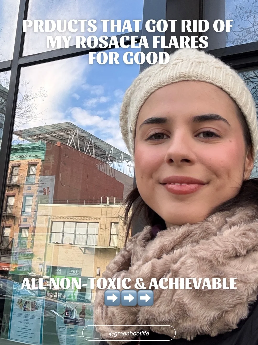 Swipe through to see ➡️➡️➡️

April is #RosaceaAwarenessMonth, and even though I share about rosacea-friendly products all year long, I wanted to make a dedicated post with the things that have been most helpful for my skin. 

Additional rosacea tips: