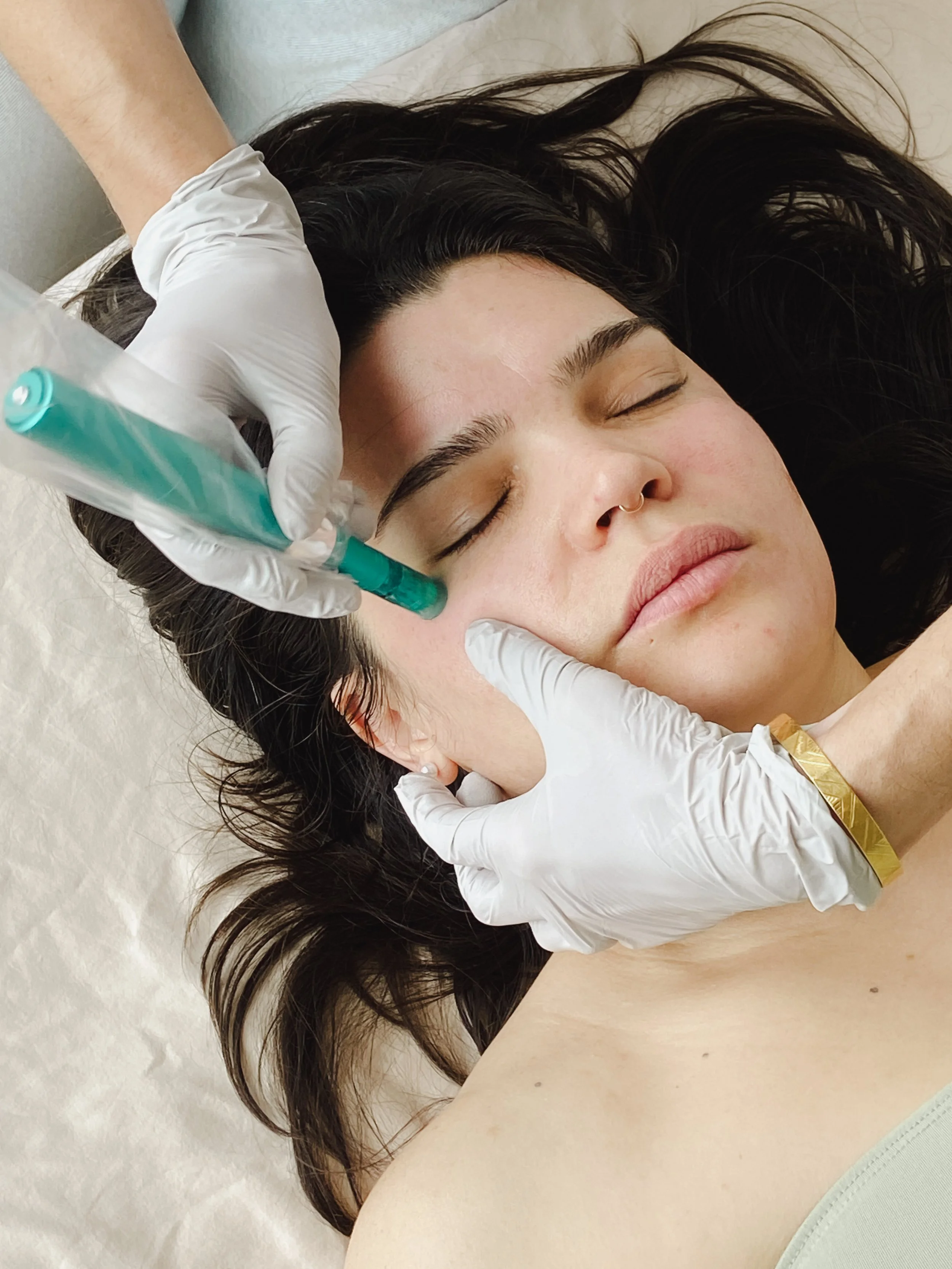 What to look for when choosing a microneedling provider in Portland