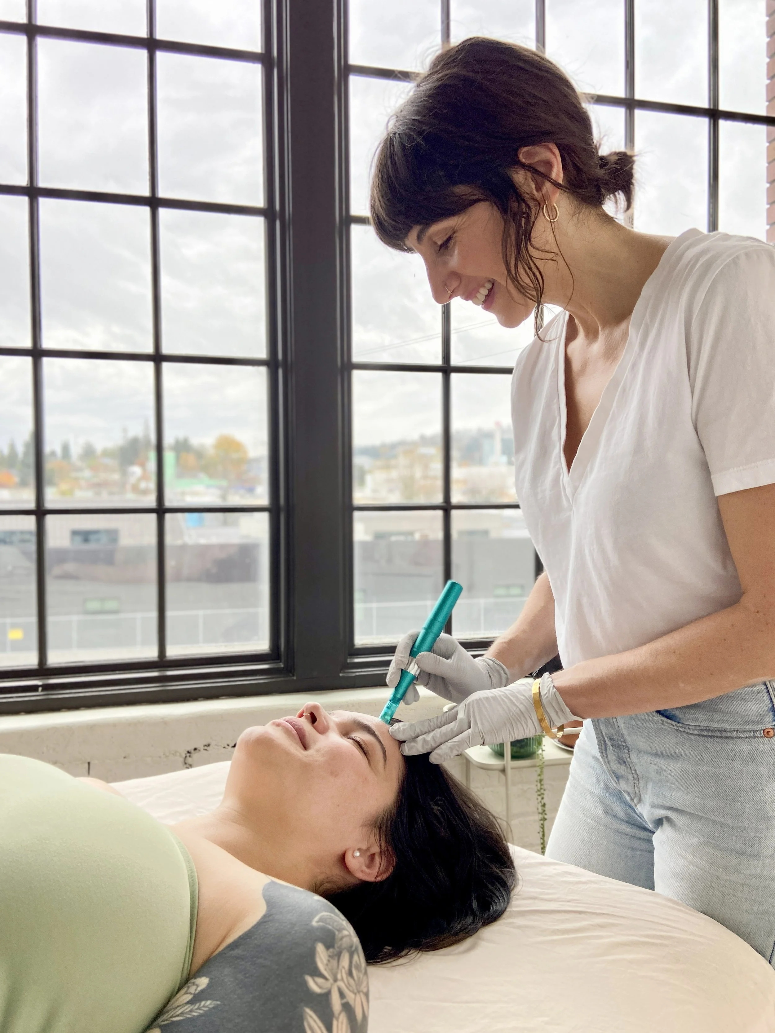 Sara Bowes performing microneedling in SE Portland acupuncture studio