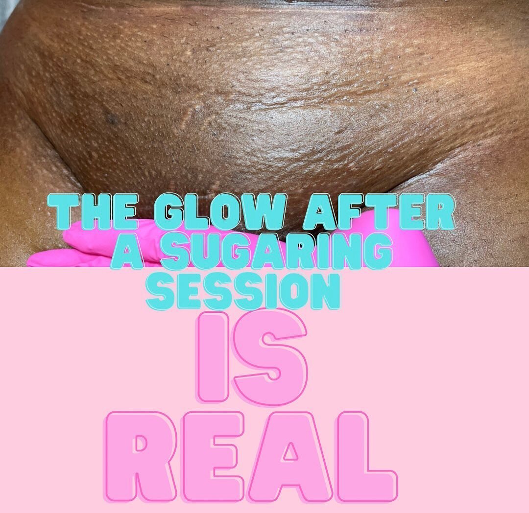 Can we all agree that your skin glows differently once you start sugaring 🤩

🍯 It really does though! Sugaring is a 100% natural way to help decrease hyperpigmentation from frequently shaving, scaring, and bumps. 💫💫