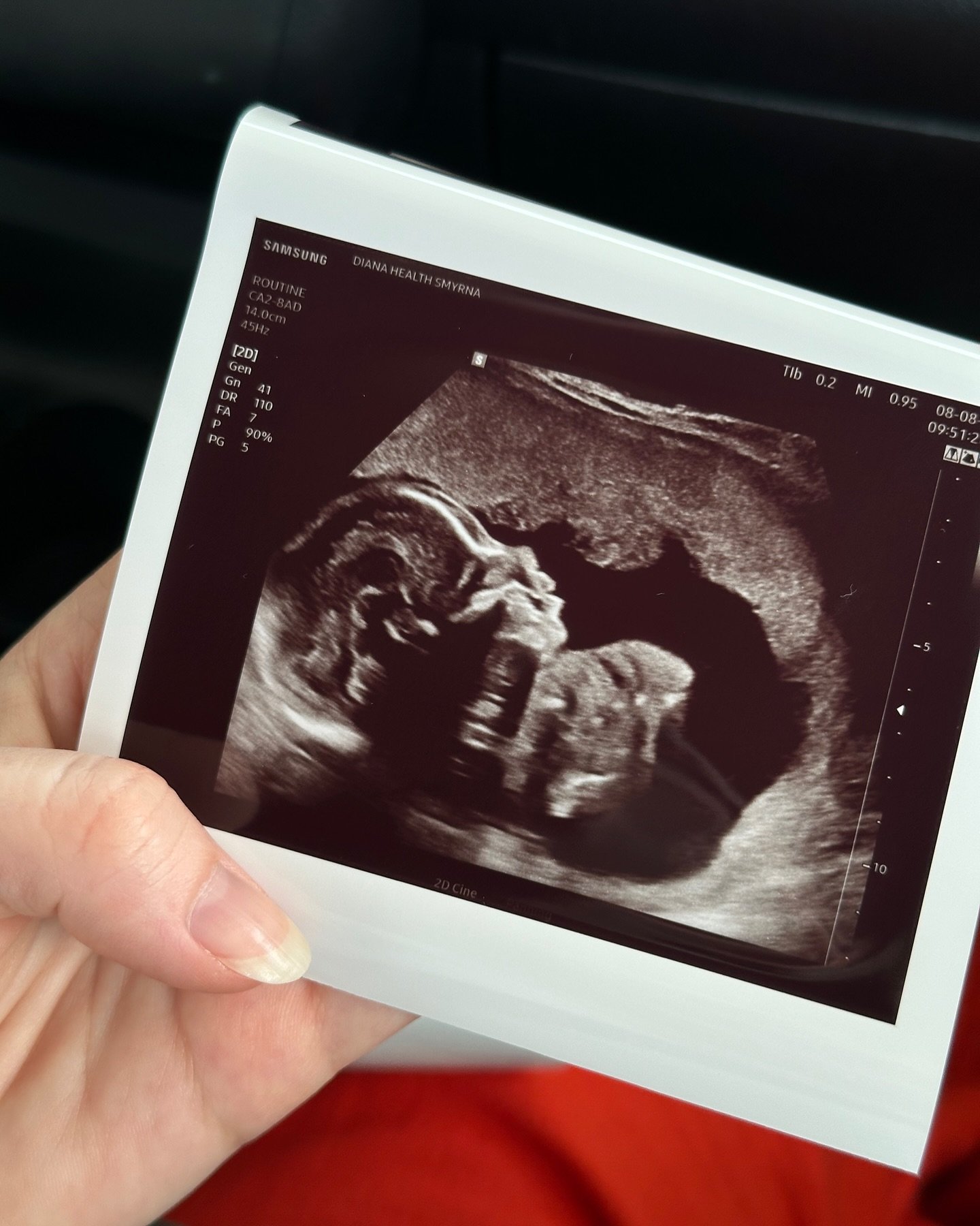 Baby GIRL coming in December!!! 💕🎀🥰
⠀⠀⠀⠀⠀⠀⠀⠀⠀
If it seems like I disappeared off the face of the earth this year, it&rsquo;s because I was deep in first trimester/ morning sickness world for what felt like FOREVER 😅 Finally coming up for air and 