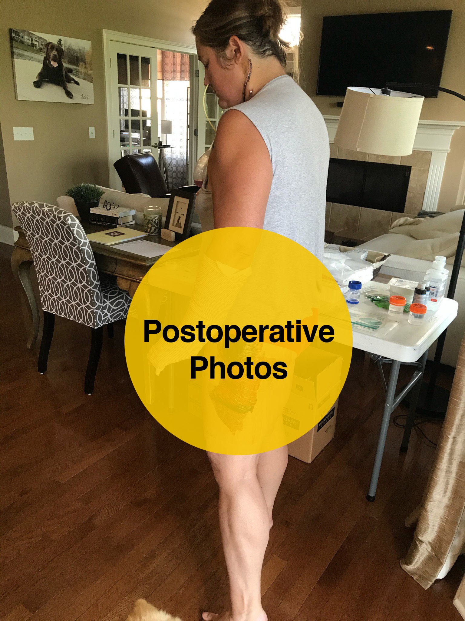 A timeline of my healing in photos and why I decided to share so much.