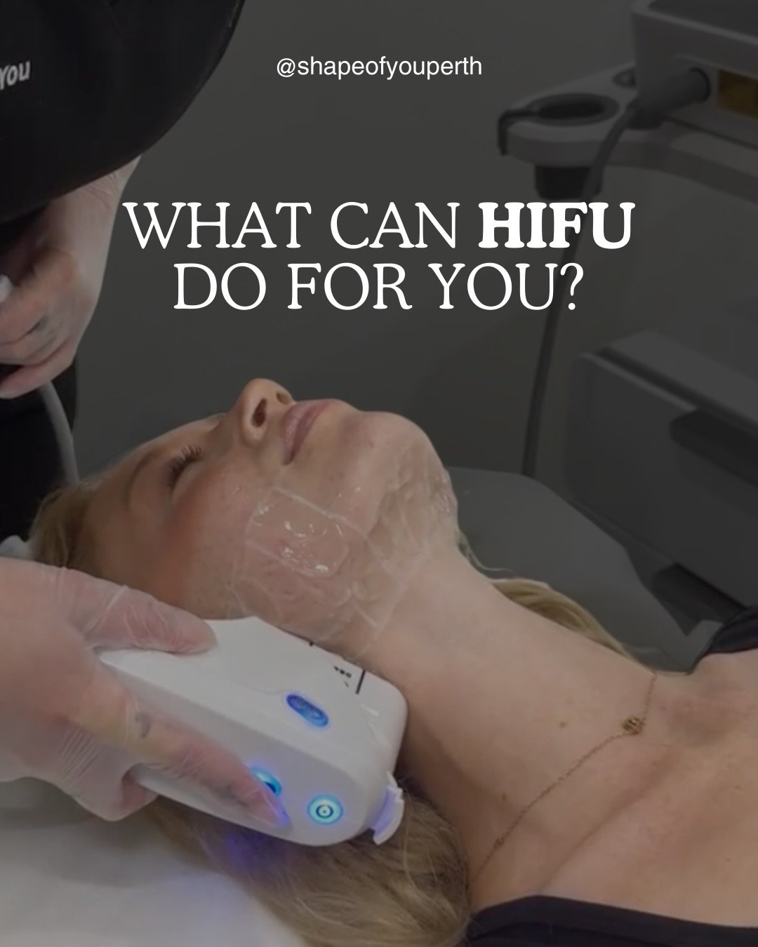 Stronger jawline.
Tighter skin.
More lifted and contoured. 

HIFU works by targeting deep structural layers of the skin to tighten sagging, improve laxity and visibly lift areas like the chin, jawline and jowls over time.

This isn&rsquo;t a facial.
