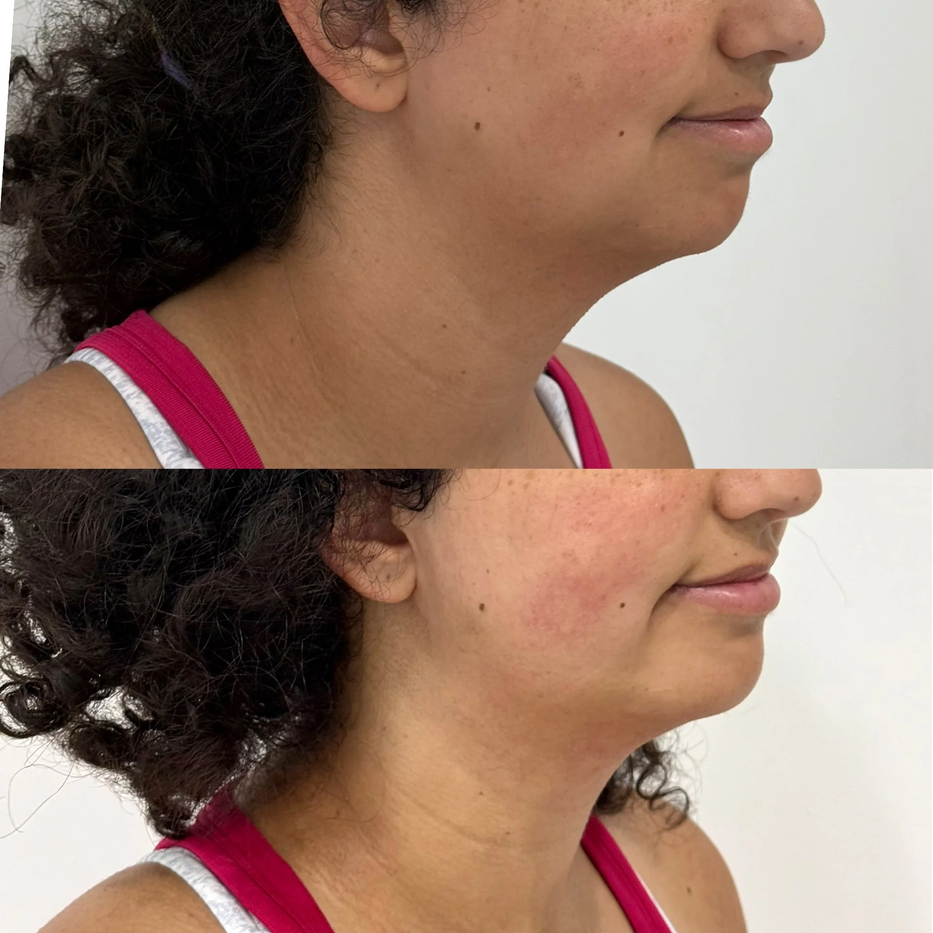 Close-up side profile of a woman with dark curly hair, wearing a pink and white tank top, standing against a white background.