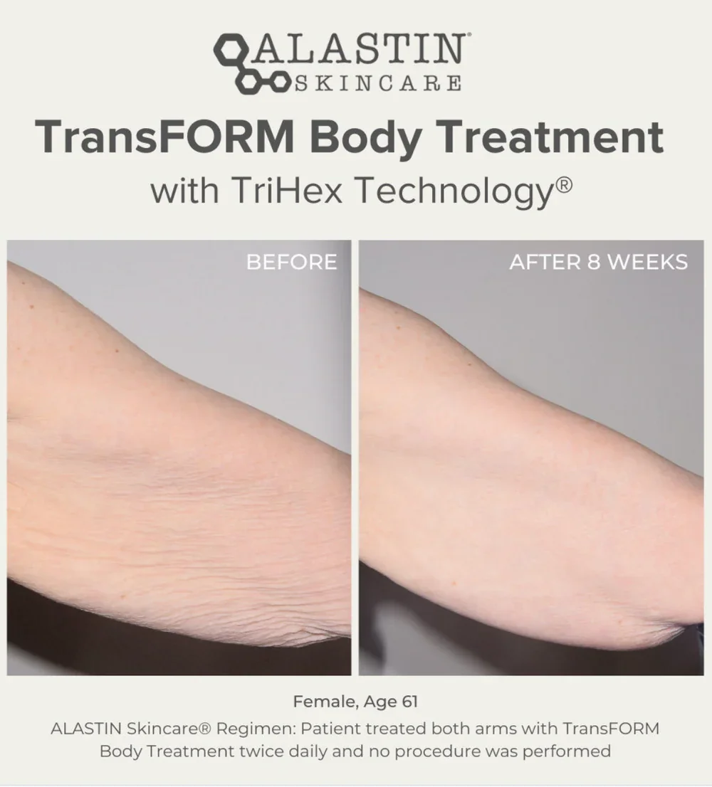 TransFORM Body Complex.webp