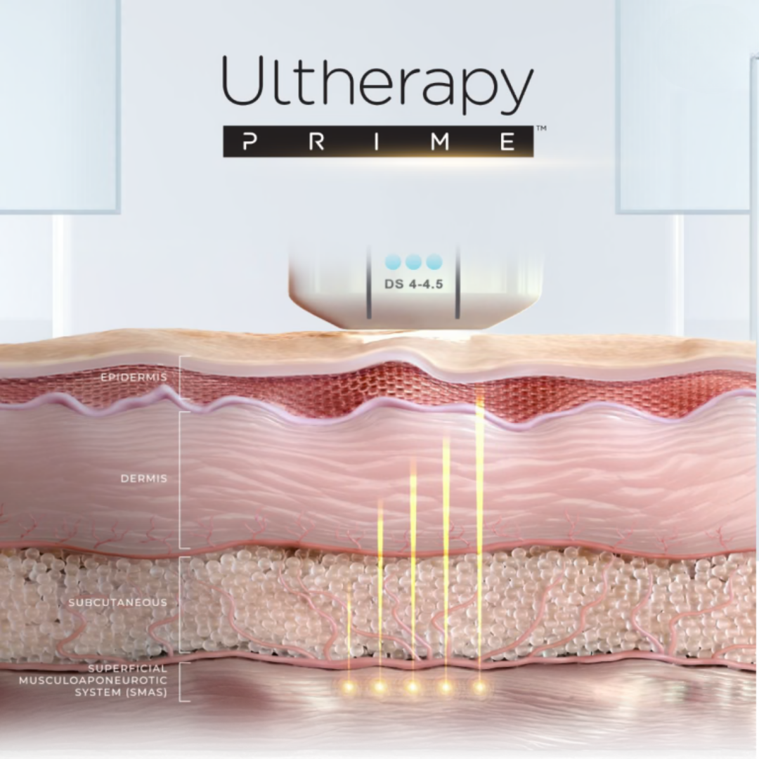 Ultherapy Prime ultrasound skin tightening machine