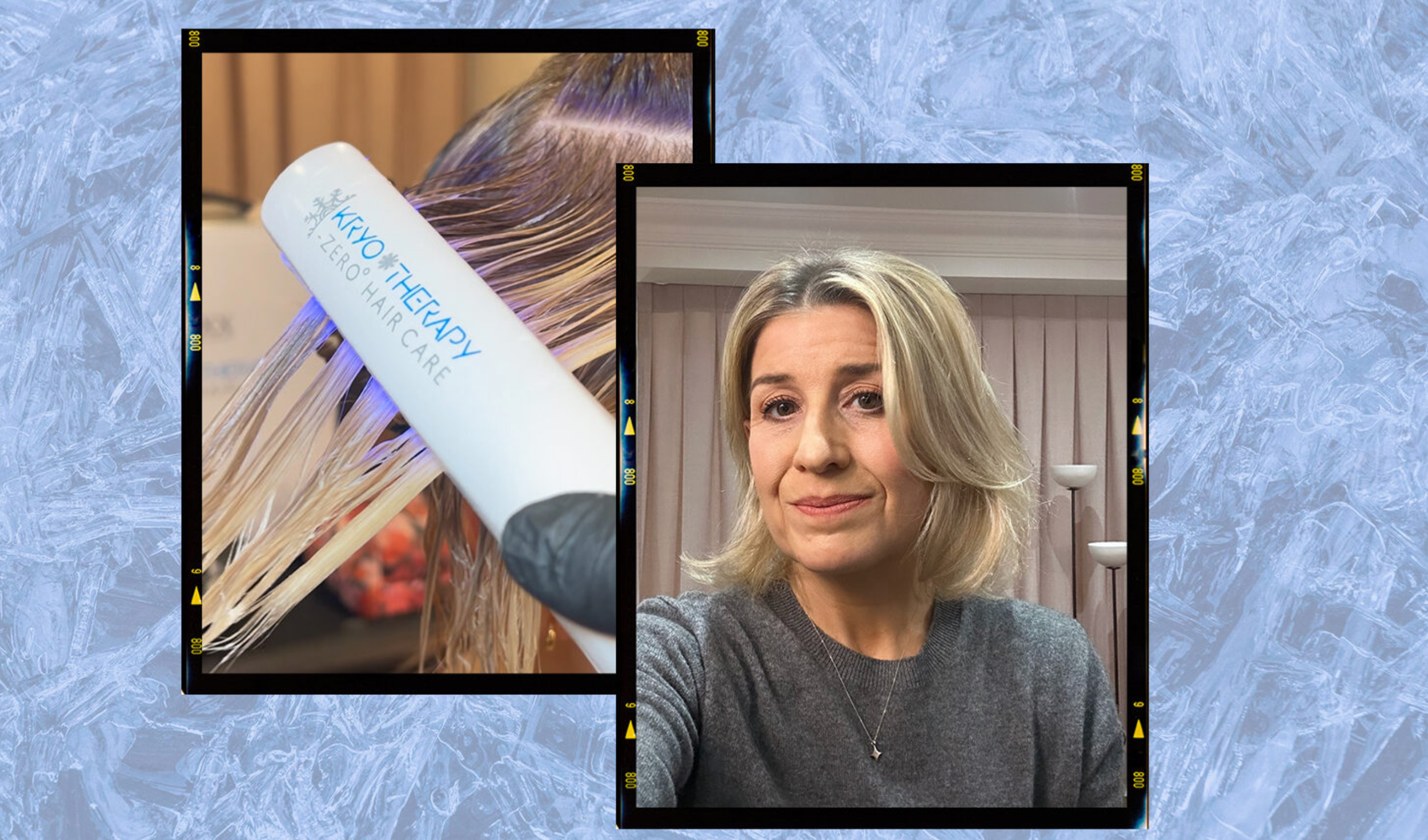 Cryotherapy for this machine in use in central London hair salon