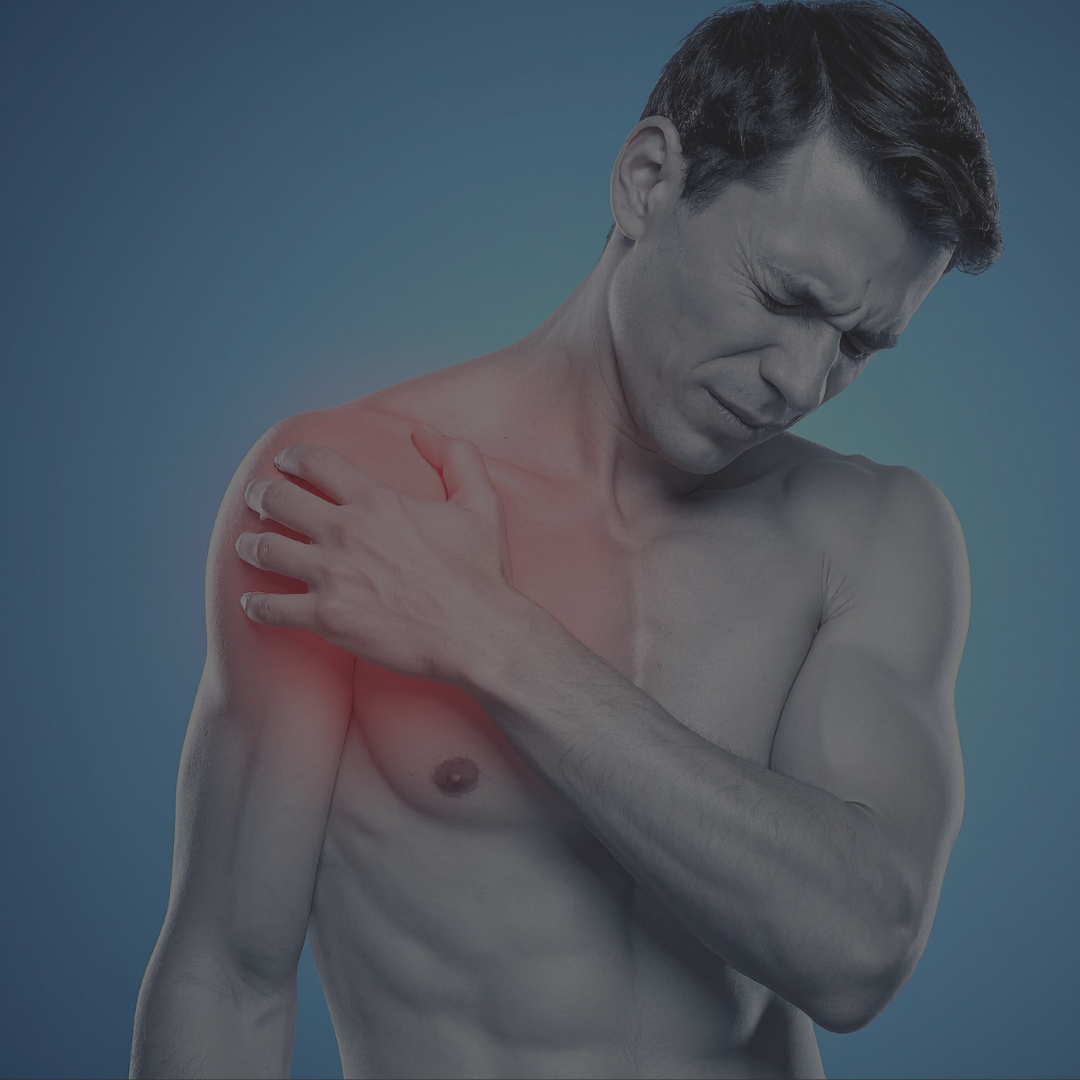 Shoulder Impingement: Understand, Modify, and Recover