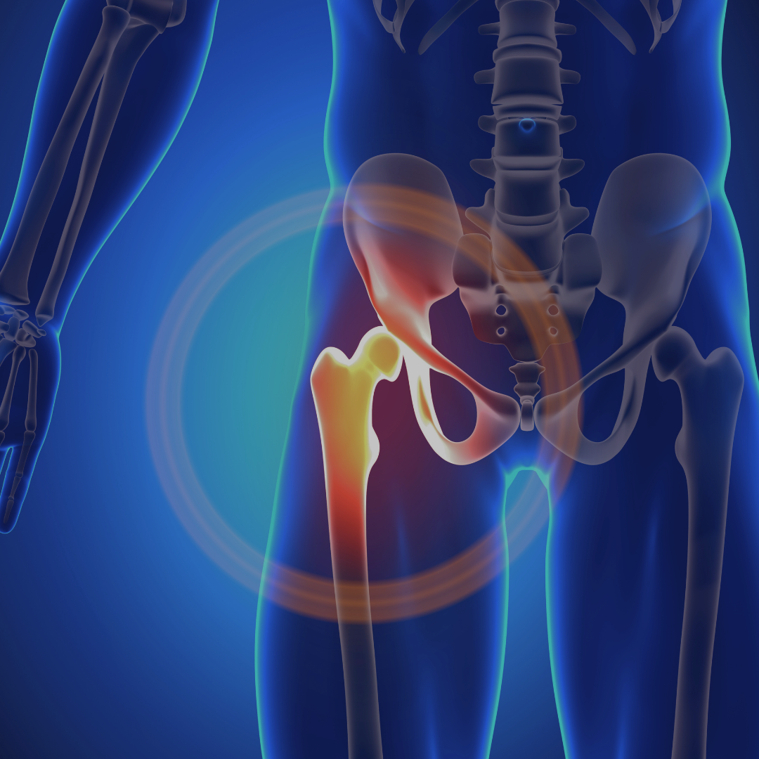 Why Hip Flexor Pain Limits Running and HYROX Performance