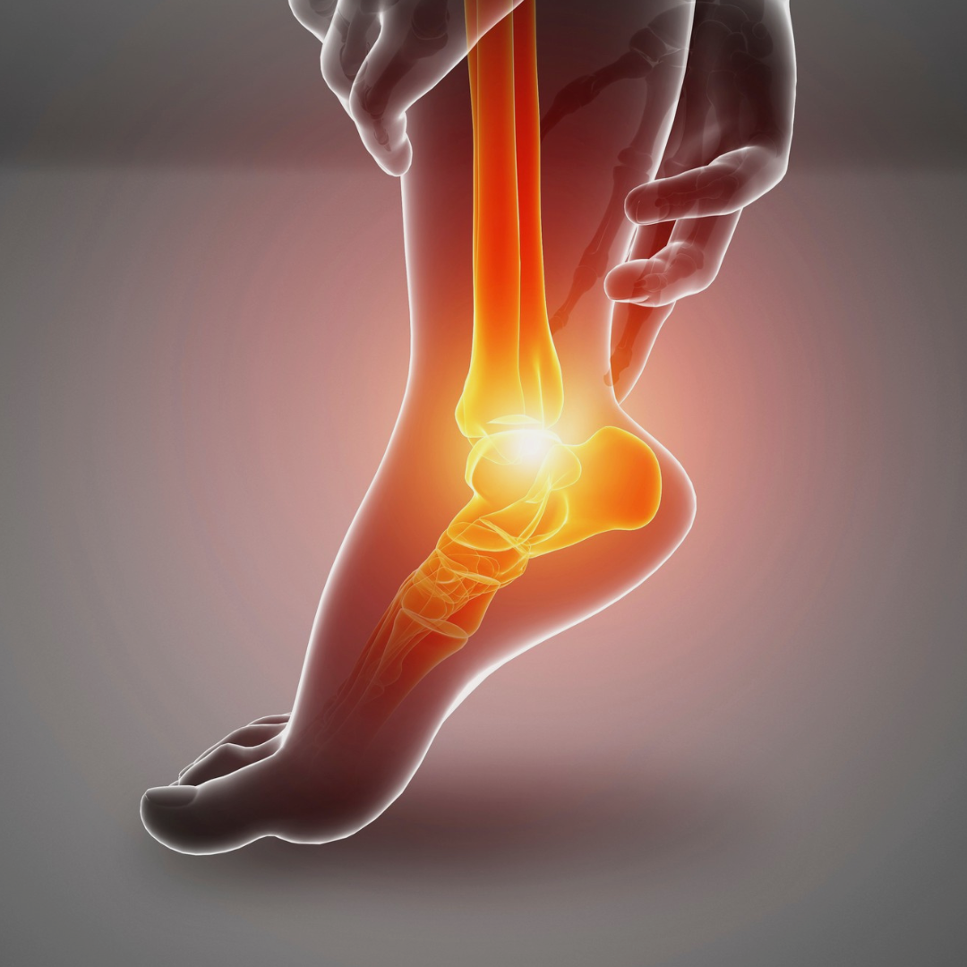 Why Heel Pain Persists Even When You Stretch: What Athletes Are Missing