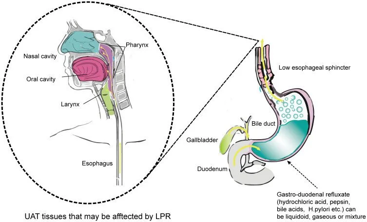 Laryngopharyngeal Reflux (LPR): When Reflux Masquerades as Postnasal Drip