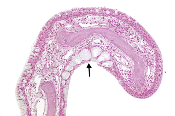 Increased mucus glands