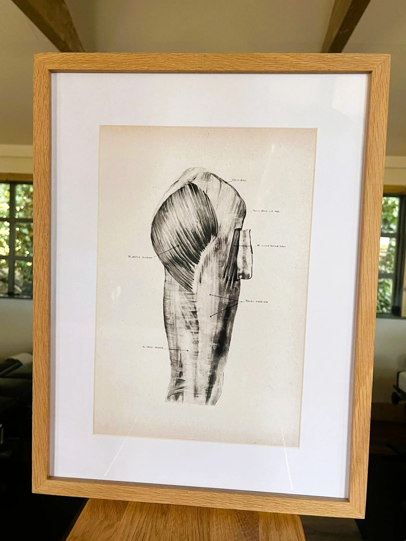 ⚡ Got Sciatica? Here’s How Chiropractic Can Help Ease That Nerve Pain Naturally 💆‍♀️🌿&nbsp;