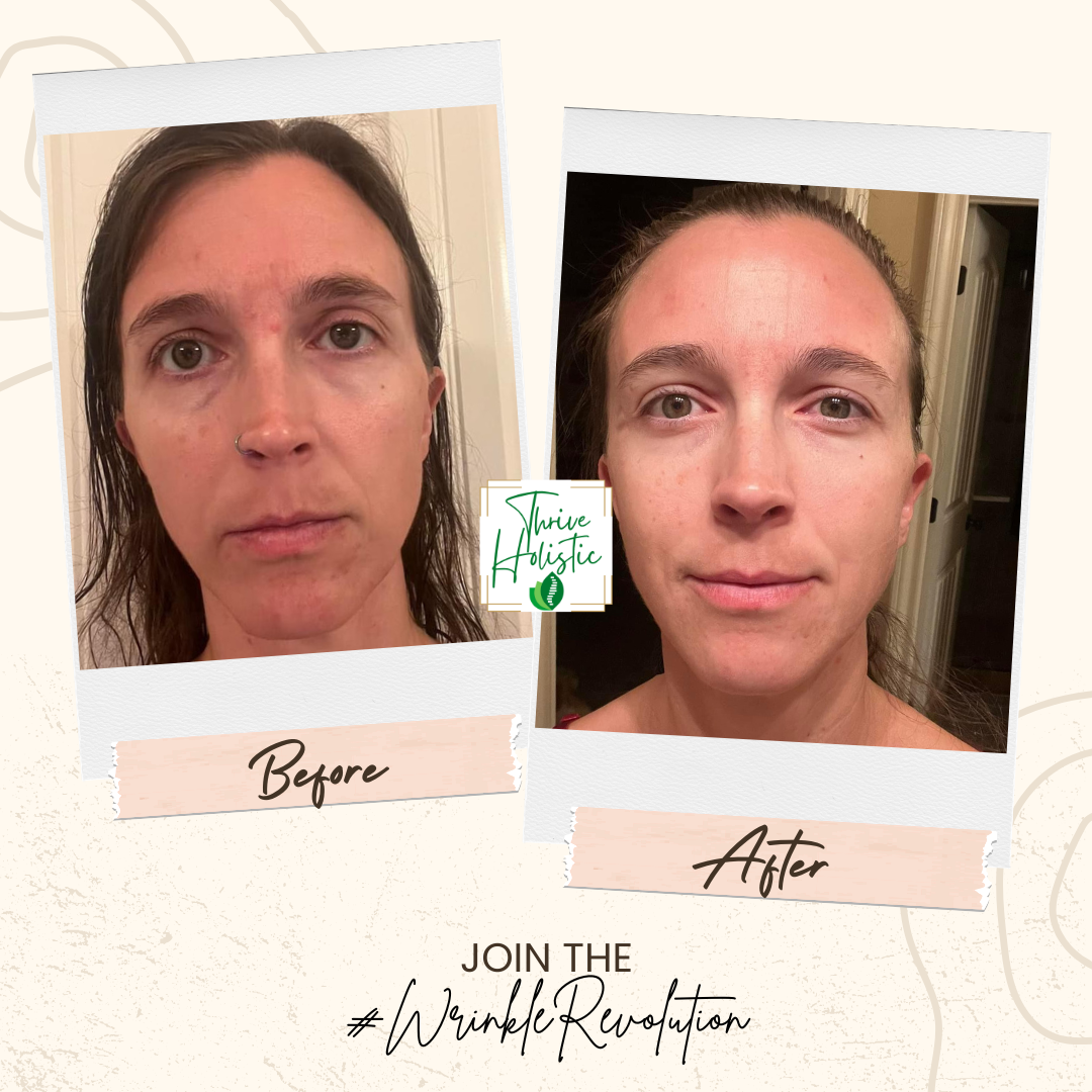 WR Before:After 1.png