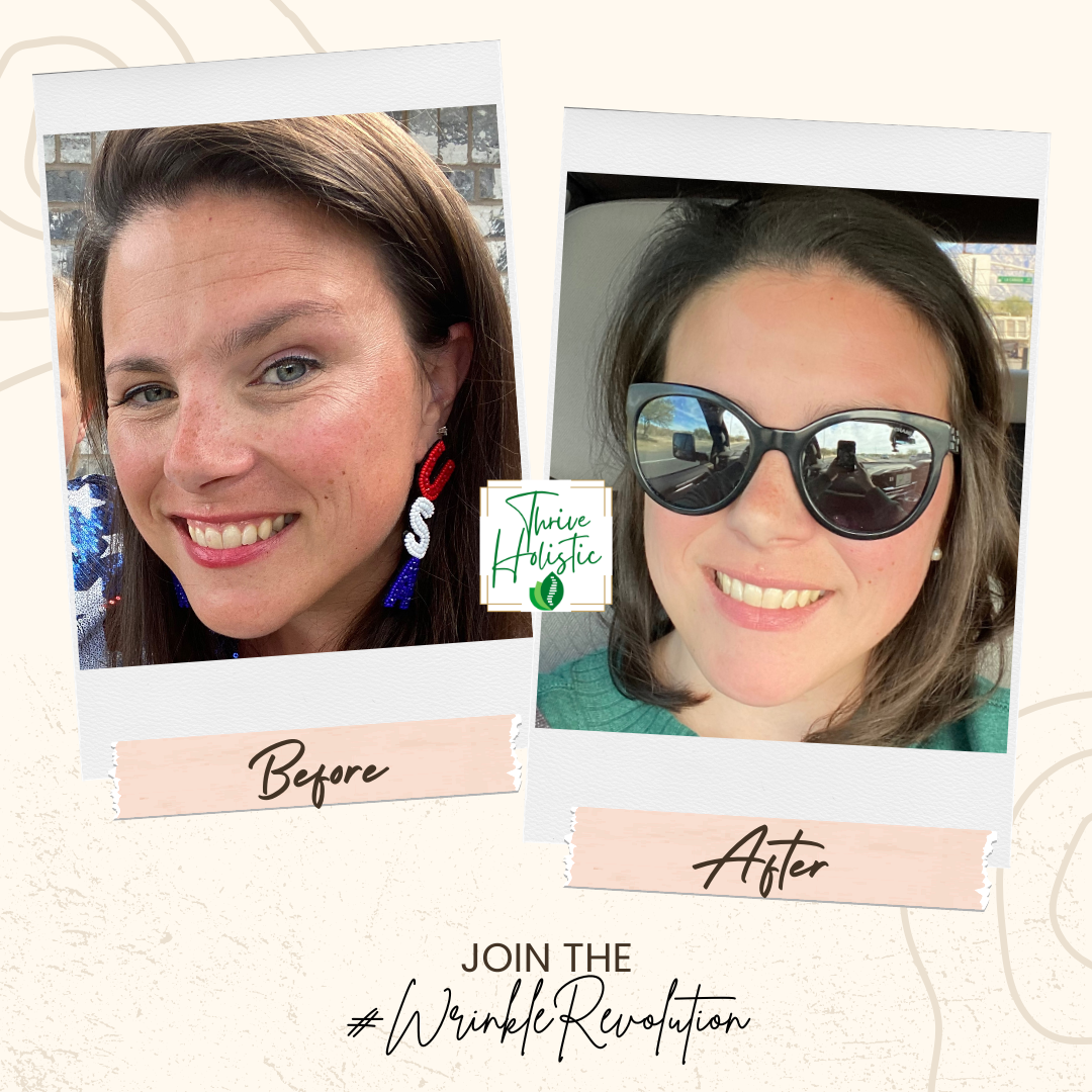 Wrinkle Revolution Results 1.png