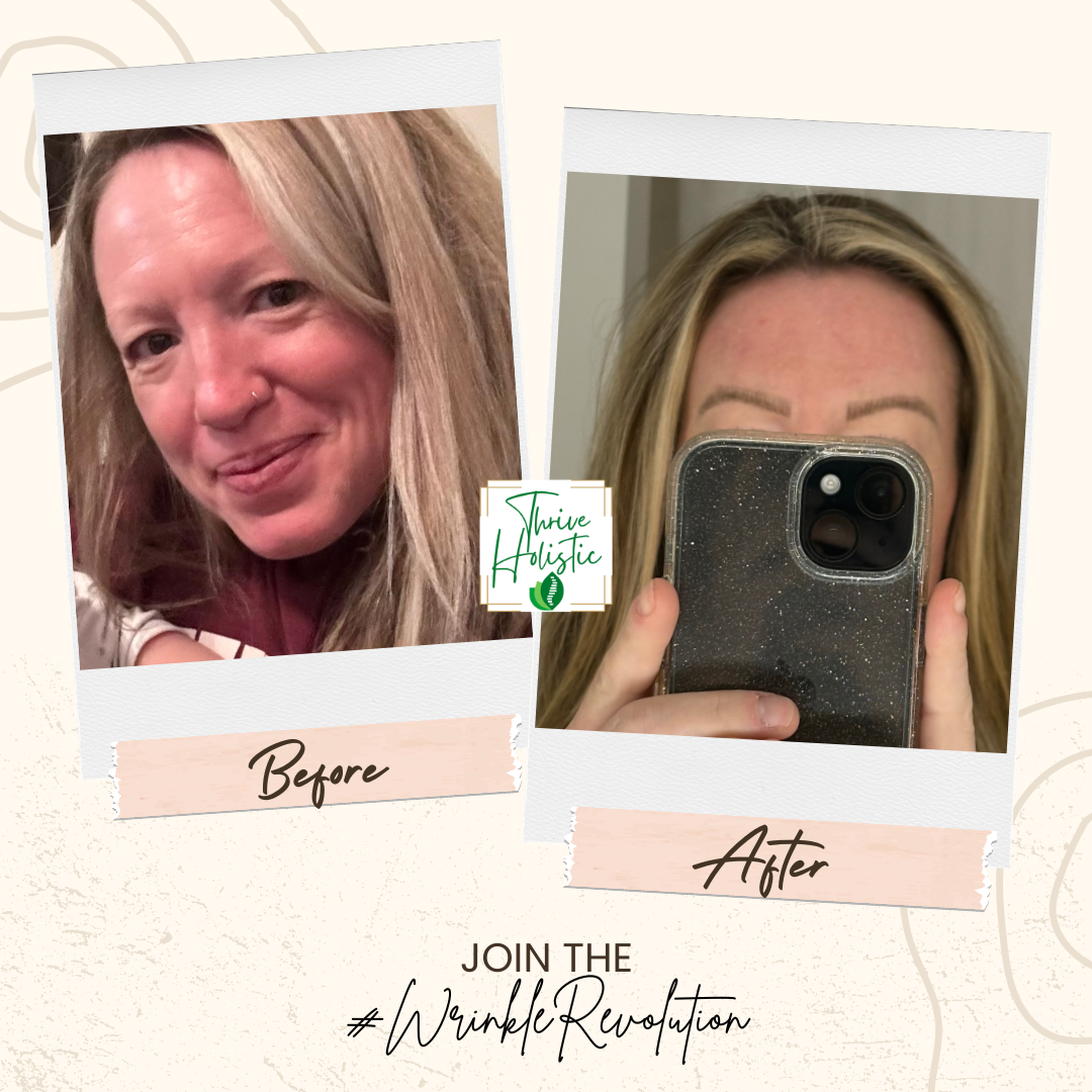 Wrinkle Revolution Results 2.png