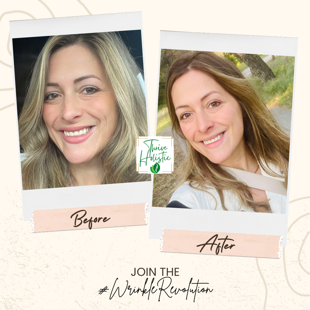 WR Before After 4.png