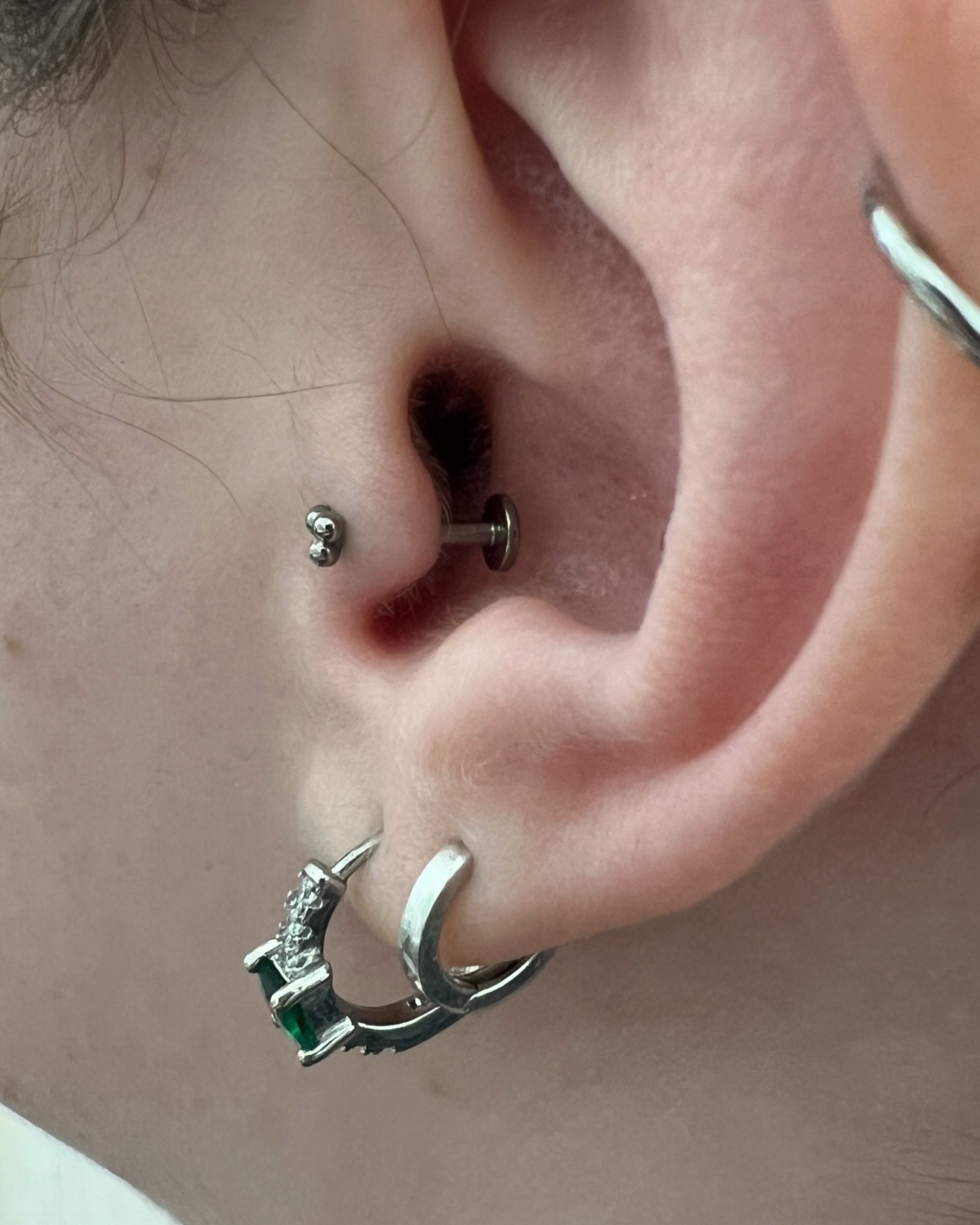 A little before and after downsize on a tragus piercing I did back in January. Downsizing is crucial for the health of your piercing. Because of this, I include downsizing in the service fee of some piercings. (Helix, forward helix, and flat within 1