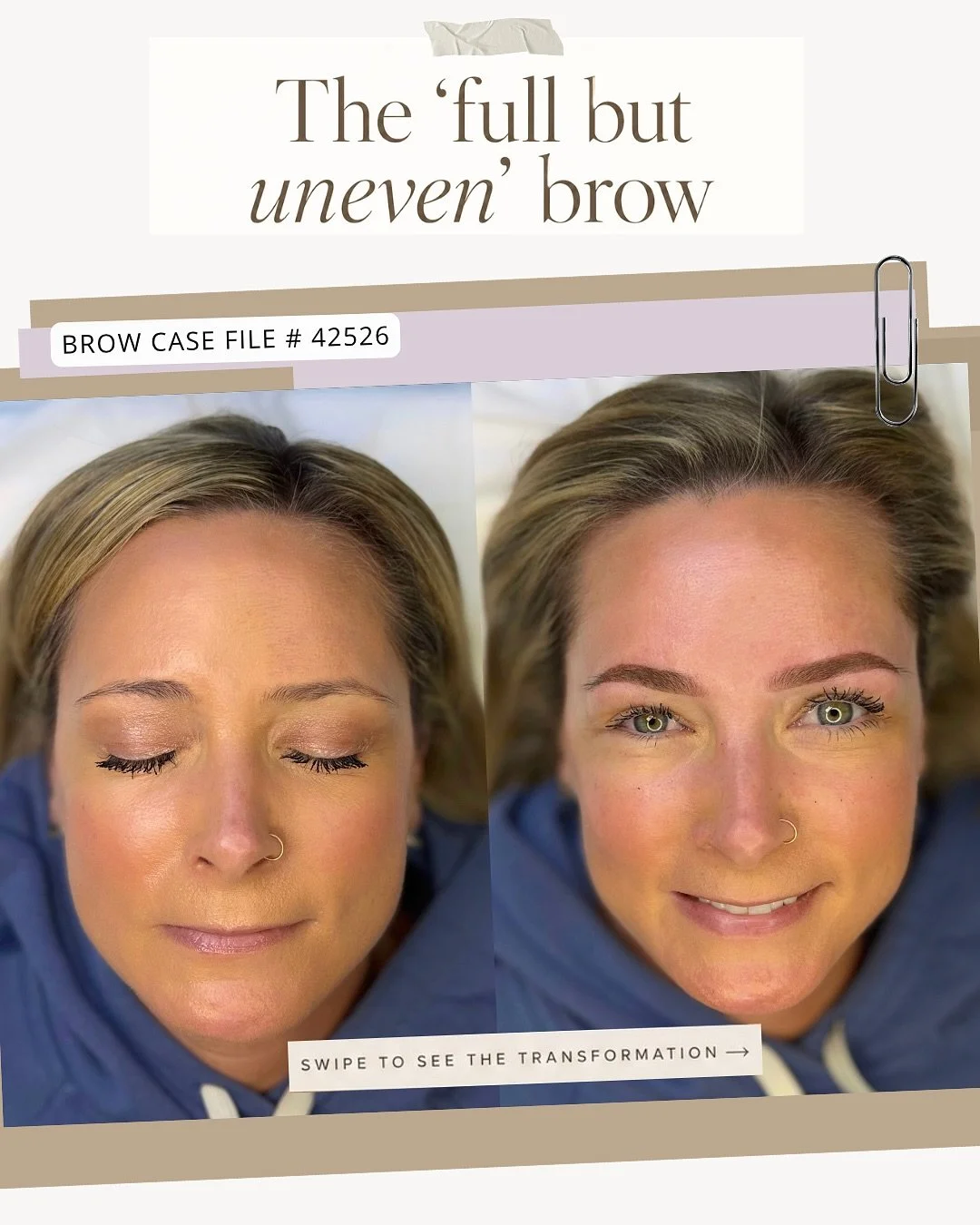 BROW CASE FILES 🗂️🤎

Her main concern was having to fill in her brows every morning! 🕰️

🏹The goal was to create more symmetrical balance, fill sparseness in certain areas, and brows that felt more effortless every day. 

🤎 Service: OMBR&Eacute;