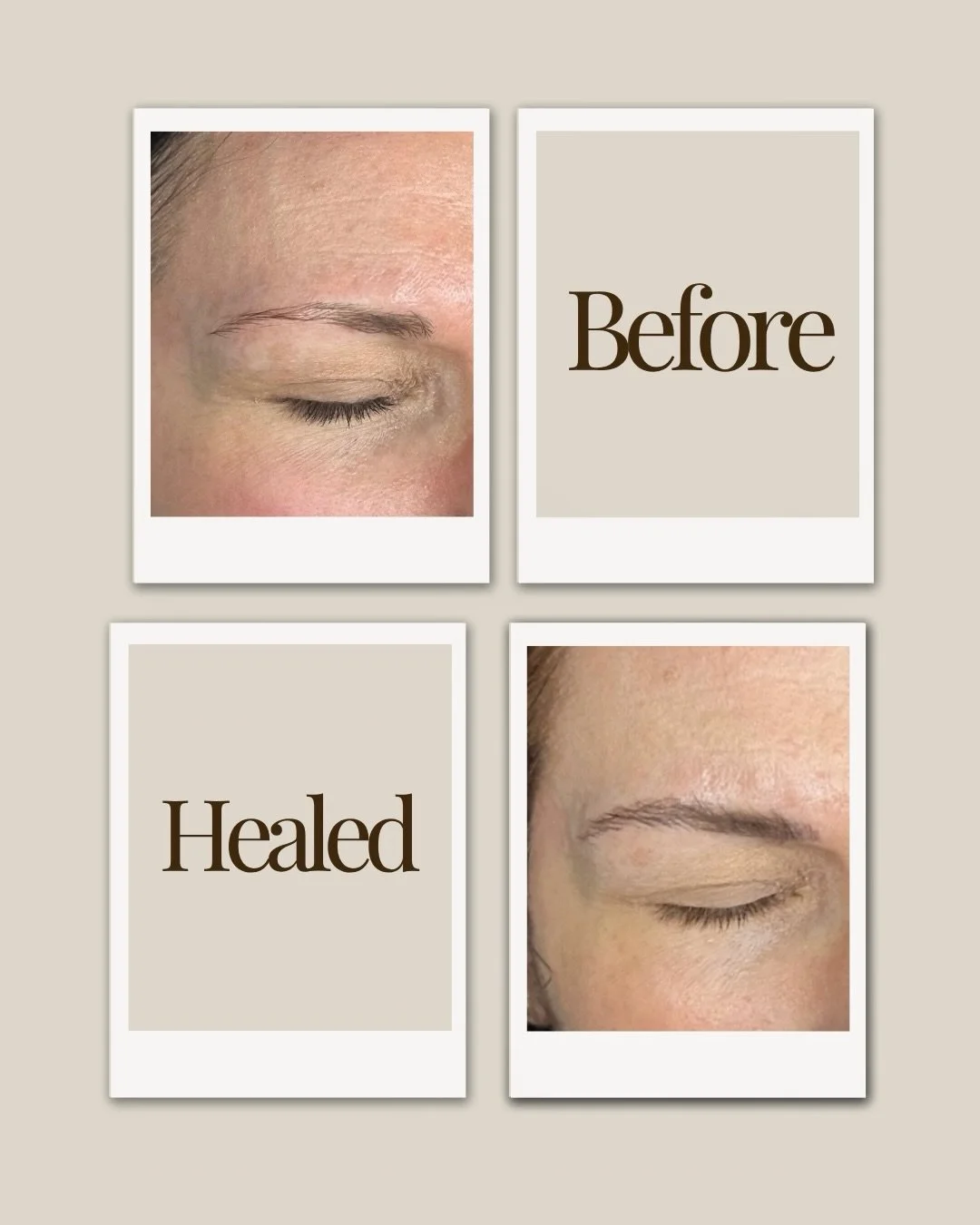 The best permanent makeup doesn't look like permanent makeup. 🤍

Because the goal is brows that still look like you. 🪽

💌 Ready for effortless brows? DM "BROWS" to book your complimentary consultation.

Seattle Nano Brows &bull; Puyallup