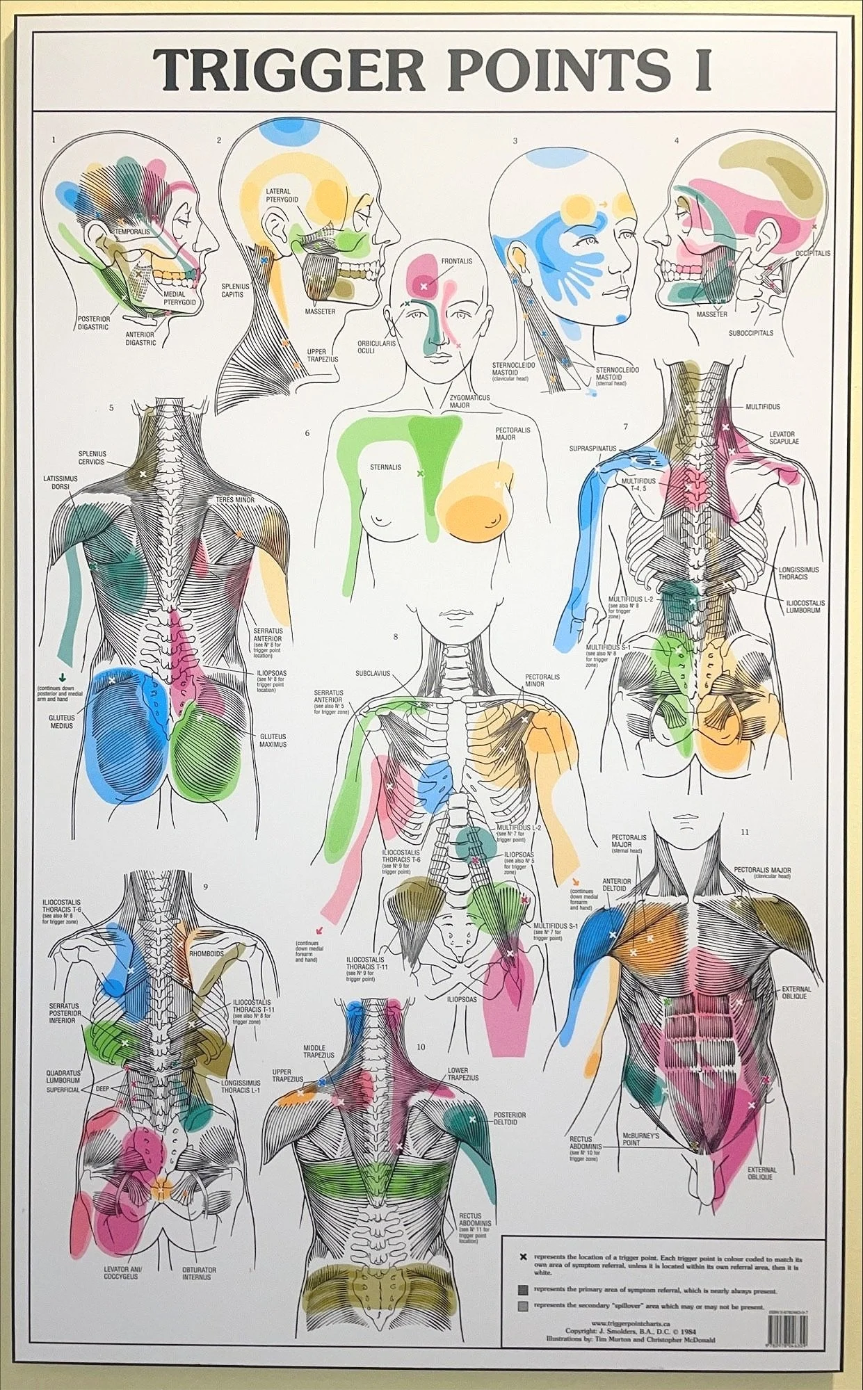 Discover Trigger Point Relief: Treatment Options at Living Well Center ...